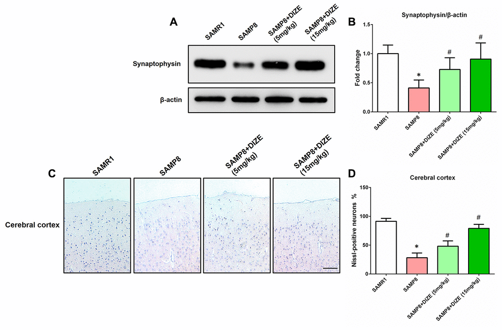 DIZE alleviated synaptic and neuronal losses in the brain of SAMP8 mice. (A) The protein levels of synaptophysin in the brain were detected by western blot. β-actin was used as a loading control. (B) Quantitative analysis of synaptophysin protein levels. Data were expressed as a fold change relative to the age-matched vehicle-treated SAMR1 control mice. (C) Neuronal loss in the parietal cortex of mice were detected by Nissl staining. Neurons with dark violet nucleus and intact morphology were identified as Nissl-positive neurons. Scale bar=100 μm. (D) Quantitative analysis of Nissl-positive neurons in the brain. Data were analyzed by one-way ANOVA followed by Tukey’s post hoc test. Columns represent mean ± SD (n=8 per group). *PP