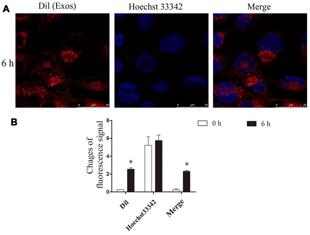 He exosomes were taken up by NRK. (A) After NRK co-cultured with exosomes, the location of Dil (red), the marker of exosomes, and nucleus (blue) were observed by confocal microscopy. (B) The changes of fluorescence intensity of Dil were analyzed by ImageJ.