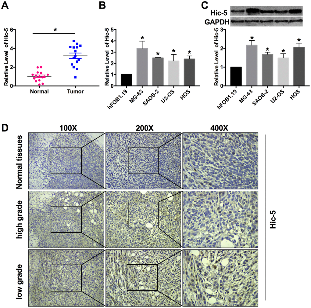 Hic-5 was up-regulation in human osteosarcoma tissues and cell lines. (A) RT-PCR was employed to detect the expression of Hic-5 in tumor and normal tissues. n=15, **PB and C) The mRNA and protein expression of Hic-5 was measured in MG-63, HOS, U2-OS and SAOS-2 cells, hFOB1.19 cells were described as control. n=8, *PD) Hic-5 staining in slides from osteosarcoma (high grade and low grade) and adjacent normal bone tissues.