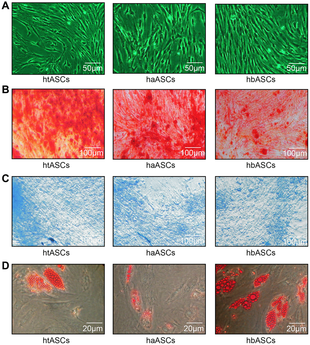 Proliferation and differentiation of haASCs, htASCs and hbASCs. (A) Passage 3 (P3) of htASCs, haASCs, and hbASCs. (B) Positive Alizarin Red staining of P3-htASCs, P3-haASCs, and P3-hbASCs following 3 weeks of osteogenic induction. (C) Positive Alcian Blue staining of P3-htASCs, P3-haASCs, and P3-hbASCs following 2 weeks of chondrogenic induction. (D) Positive Oil Red O staining of P3-htASCs, P3-haASCs, and P3-hbASCs following 2 weeks of adipogenic induction.