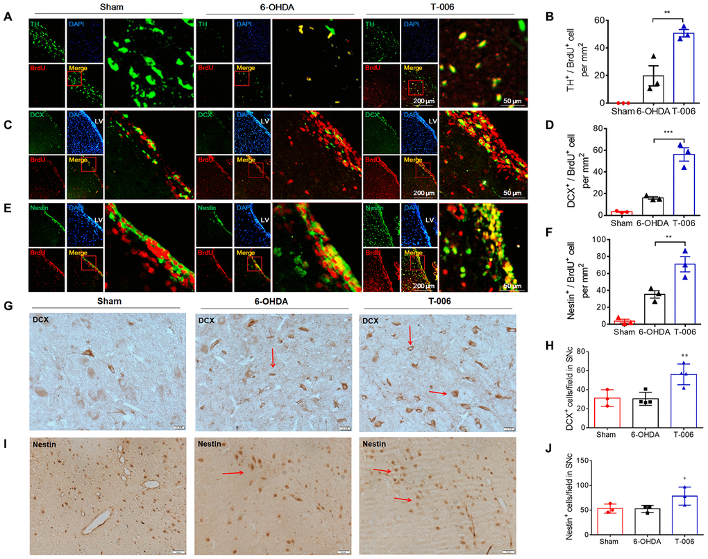 T-006 enhances neural reconstruction by stimulating neurogenesis in rat model of PD. Immunofluorescence images of ipsilateral hemisphere sections co-stained with antibodies against (A) TH (green, a marker of DA neurons) and BrdU (red, a marker of proliferating cells); (C) DCX (green, a marker of migrating neuroblasts) and BrdU (red); (E) Nestin (green, a marker of NPCs) and BrdU (red) cells. DAPI (blue) indicates nucleus. Insets show a higher magnification view of double-positive cells. Scale bar = 200 μm for whole slice, 50 μm for inset magnification. (B, D and F) Quantitative analysis of newly formed mature neurons (BrdU+/TH+, D), in the SN, migrating neuroblasts (BrdU+/DCX+, E) and proliferating NPCs (BrdU+/Nestin+, F) in the SVZ. (G and I) Immunohistochemical images of ipsilateral hemisphere sections co-stained with antibodies against DCX and Nestin in the SNc. (H and J) Quantitative analysis of DCX and Nestin-positive cells in SNc. Data are expressed as mean±SEM (n=3 to 4 per group). *P**P***P