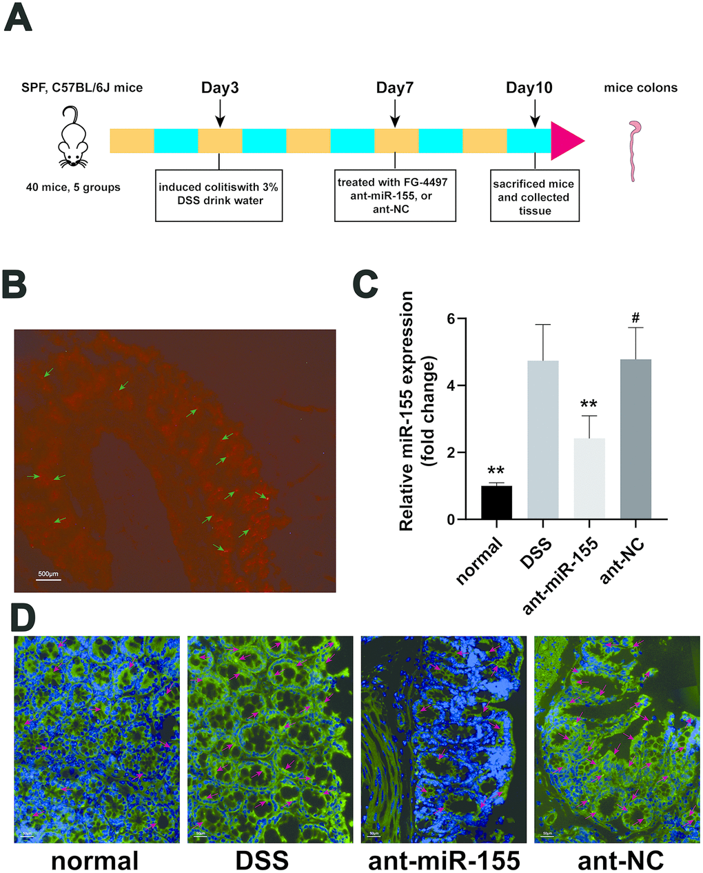 MiR-155 antagomir reduced miR-155 level in DSS-induced colitis. (A) The schema of the animal experiment. (B) Location of miR-155 antagomir in mouse colon. Red marked by green arrows was positive signal (magnification ×20). (C) QRT-PCR analysis of miR-155 level in mice colonic tissue. Each bar represents mean ± SD, n=8 from each group. #P > 0.05, **P D) In situ hybridization analysis of miR-155 in mice colon. Green marked by red arrows was positive signal for miR-155 (magnification ×200).