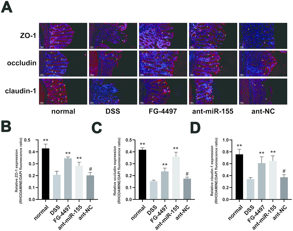 Immunofluorescence assay presented the expression of TJ proteins in mice colon. (A) Immunoflorescent staining of ZO-1, occludin, and claudin-1 in the colonic tissues. (magnification, ×200) Red signal (rhodamine) labeled by green arrows was positive for these proteins. DAPI (blue) was used to counterstain of nuclei. (B–D) Relative ZO-1, occludin, and claudin-1 expression measured by rhodamine and DAPI fluorescence ratio in all groups were presented. Each bar represents mean ± SD, n=5 from each group, #P > 0.05, *P 