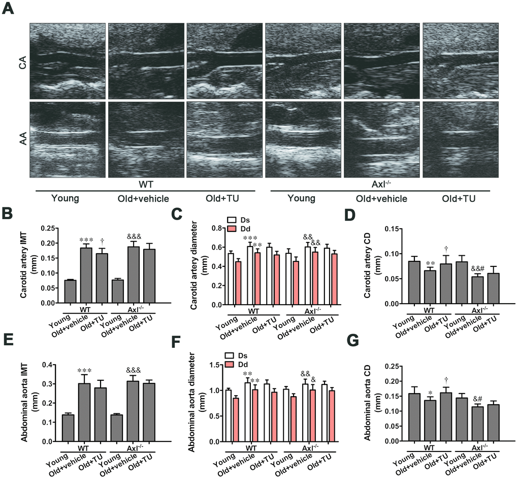 The role of testosterone and Gas6/Axl in structural changes of aging vessel. (A) Carotid artery (CA) and abdominal aorta (AA) of ultrasonography. (B) Intima-media thickness (IMT) of carotid artery. (C) Systolic diameter (Ds) and diastolic diameter (Dd) of carotid artery. (D) Coefficient distention (CD) of carotid artery. (E) IMT of abdominal aorta. (F) Ds and Dd of abdominal aorta. (G) CD of abdominal aorta. Data are mean ± SD; *P **P ***P vs. WT young group; †P vs. WT old group; &P &&P &&&P vs. Axl-/- young group; #Pvs. Axl-/- old group; n = 8 for each group.