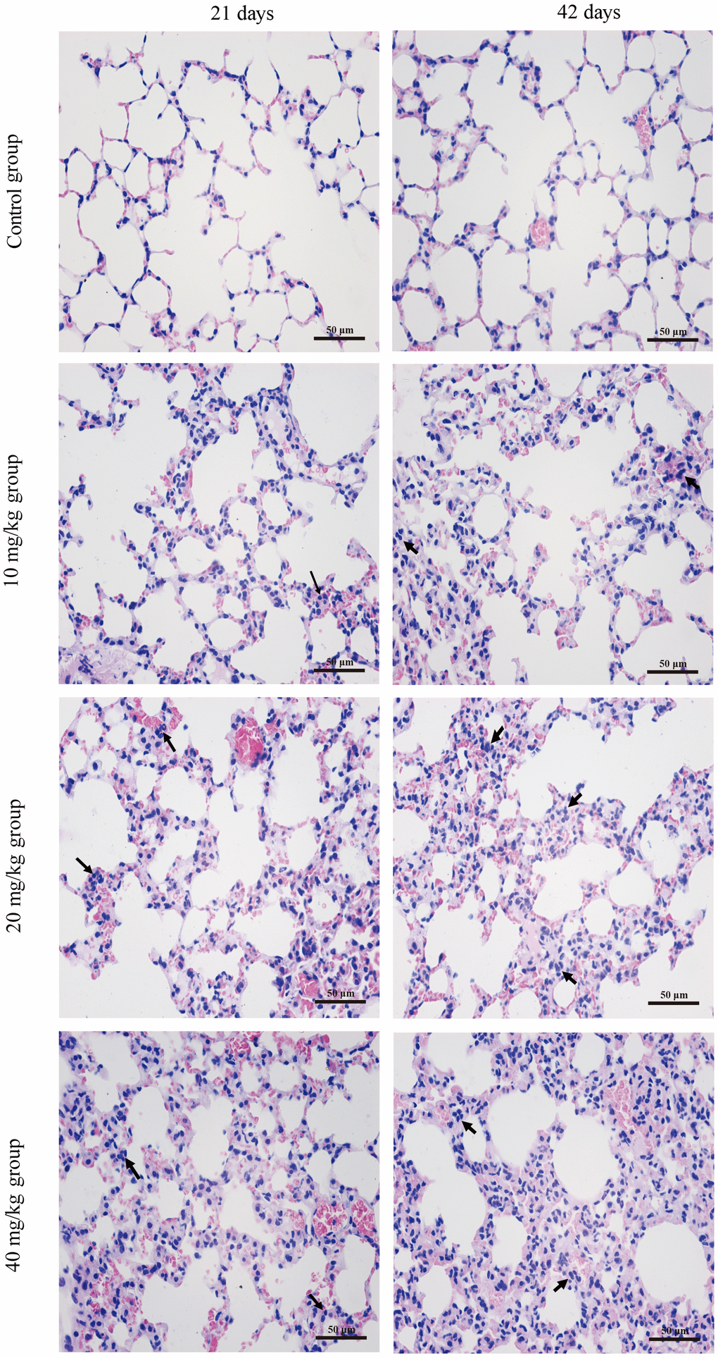 Histopathological changes in the lung at 21 and 42 days of the experiment. (H&E ×400). Control group at 21 and 42 days: no changes are observed. 10 mg/kg group at 21 days: the inflammatory cells (↑) are obviously observed in alveolar walls. 20 mg/kg group at 21 days: the alveolar walls are slightly thickened with inflammatory cell infiltration (↑) 40 mg/kg group at 21 days: the alveolar walls are obviously thickened with inflammatory cell infiltration (↑). 10 mg/kg group at 42 days: the alveolar walls are slightly thickened with inflammatory cell infiltration (↑). 20 mg/kg group at 42 days: the alveolar walls are thickened with inflammatory cell infiltration (↑). 40 mg/kg group at 42 days: the alveolar walls are markedly thickened with inflammatory cell infiltration (↑).