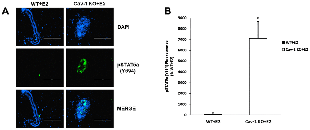 Cav-1 KO DCIS lesions display increased phosphorylated STAT5a (Y694) levels as a response to 17β-Estradiol treatment. (A) Mammary glands of estrogen-treated WT and Cav-1 KO mice were immunostained with an antibody recognizing phosphorylated STAT5a (Y694). DAPI was used as a nuclear counterstain. The EVOS FL microscope was used to capture images at 40x objective with the DAPI and CY5.5 light cubes (blue: DAPI immunostaining; green: phosphorylated STAT5a (Y694) immunostaining). For each experimental group, immunofluorescence was performed in triplicate on mammary glands derived from 3 independent mice. (B) Immunofluorescence staining was quantified using Image J software. Corrected total cell fluorescence (CTCF) was calculated using the following formula: CTCF = Integrated Density – (Area of Selected Region x Mean Fluorescence of Background). Cav-1 KO mammary glands demonstrated a significant increase in phosphorylated STAT5a (Y694) expression compared to estrogen-treated WT counterparts (71.1-fold, p