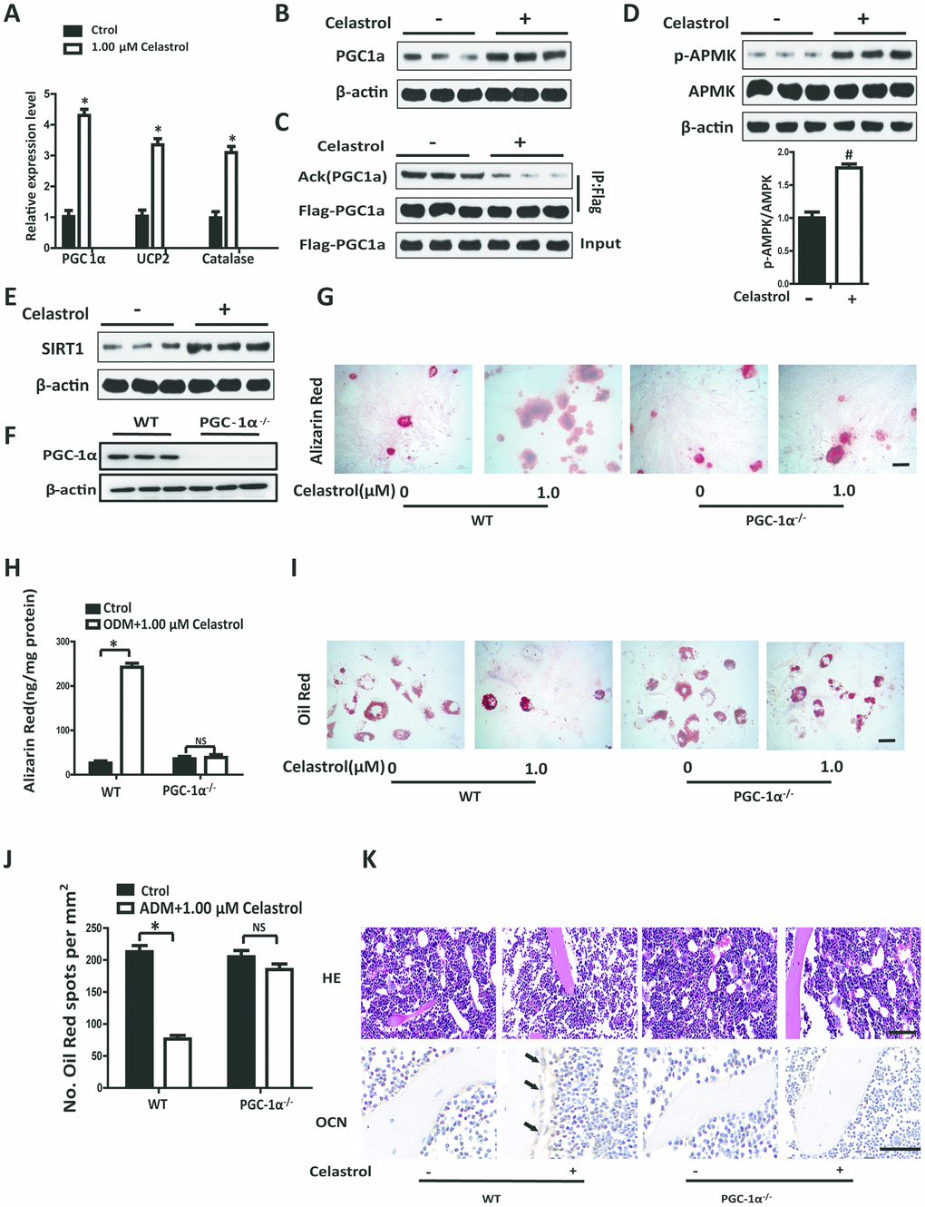 Celastrol regulated the differentiation of BM-MSCs by activating PGC-1α signaling. (A) Expression levels of PGC-1α, UCP2 and Catalase in BM-MSCs treated with the vehicle or Celastrol (1.0 μM, 48 hours) (n = 3 per group). (B) Western blotting analysis of the protein levels of PGC-1α of BM-MSCs treated with the vehicle or Celastrol (1.0 μM, 48 hours). (C) Western blotting analysis for the detection of PGC1α acetylation levels in PGC1α immunoprecipitates obtained from BM-MSCs transfected with pcDNA-Flag-PGC1α and treated with the vehicle or Celastrol (1.0 μM, 48 hours). (D) Western blotting analysis for the detection of pAMPK in BM-MSCs treated with the vehicle or Celastrol (1.0 μM, 48 hours). The levels of pAMPK were quantified using ImageJ software and were normalized to total AMPK levels (D, bottom). (E) Western blotting analysis of the protein levels of SIRT-1 in BM-MSCs treated with the vehicle or Celastrol (1.0 μM, 48 hours). (F) Western blotting analysis of the relative levels of PGC-1α in BM-MSCs transfected with PGC-1α siRNA. (G, H) Representative images of Alizarin Red staining (G) and quantitative analysis (H) of matrix mineralization of BM-MSCs cultured in the osteogenesis induction medium for 21 days. Scale bar: 100 μm. (I, J) Representative images of Oil Red O staining of lipids (I) and quantification of the number of spots (J) on BM-MSCs cultured in the adipogenesis induction medium for 14 days. Scale bar: 100 μm. (K) PGC-1α-knockout (PGC-1α-/-) mice (2 month old) and WT mice (2 month old) were ovariectomized. 12 weeks later, they were intraperitoneally injected with Celastrol (200 μg/kg) or DMSO (control) every two days for 4 weeks. H&E staining (top) and osteocalcin immunohistochemical staining (bottom) of the bone were conducted to evaluate the numbers and area covered by adipocytes and osteoblasts after Celastrol treatment. Scale bar: 100 μm. Data are presented as mean ± SD. Statistical significance was determined using the t-test. *P #P 