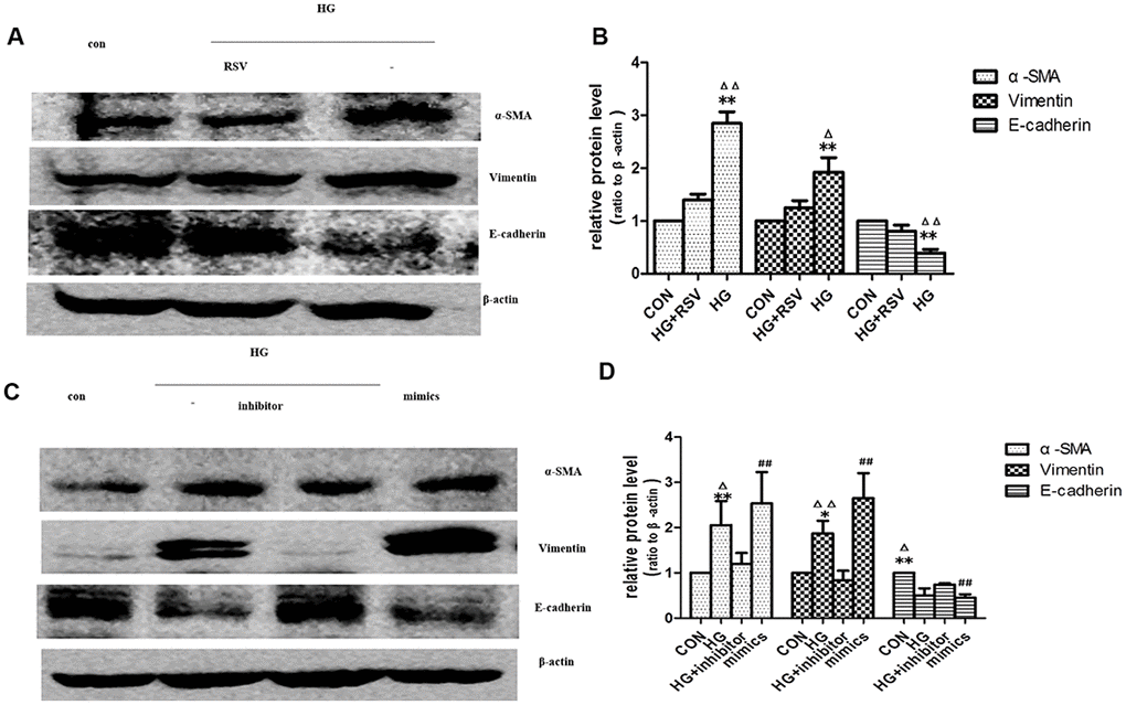 Exogenous miR-21 was delivered by EVs into recipient tubular cells and promoted EMT. (A) Western blot analysis showed that resveratrol inhibited senescence of recipient cells, blocking EVs from high-glucose conditioned medium induced decline of E-cadherin and increase of α-SMA and vimentin. (C) Western blot analysis showed that inhibition of miR-21 by transfection of miR-21 inhibitor in recipient cells blocked EVs from high-glucose conditioned medium induced decline of E-cadherin and increase of α-SMA and vimentin. Upregulation of miR-21 by miR-21 mimics transfection in recipient cells promoted EVs-induced inhibition of E-cadherin and inductions of α-SMA and vimentin expression. (B, D) Quantitative analysis of band density for the proteins. The protein expression data are presented as the mean ± SD. * p Δp # p ΔΔ/## p 