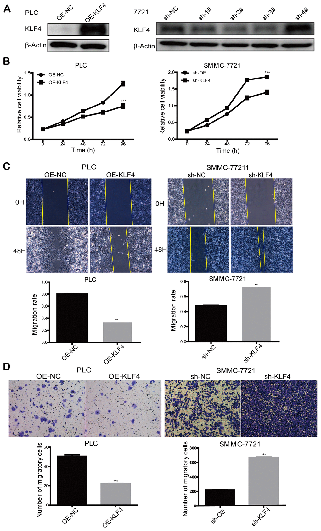 KLF4 inhibits the proliferation and migration ability of HCC cells. (A) Knockdown of KLF4 in SMMC-7721 and overexpression of KLF4 in PLC/PRF/5 was verified by western blot, and β-actin was used as an internal control in western blot assays. (B) CCK8 assay was implemented to detect the proliferation rate of steadily transfected SMMC-7721 and PLC/PRF/5. (C) Cell wound scratch assay and (D) transwell assay was executed to evaluate the migration rate of steadily transfected SMMC-7721 and PLC/PRF/5. Student’s t-test was used in line charts and bar charts. P P P P 