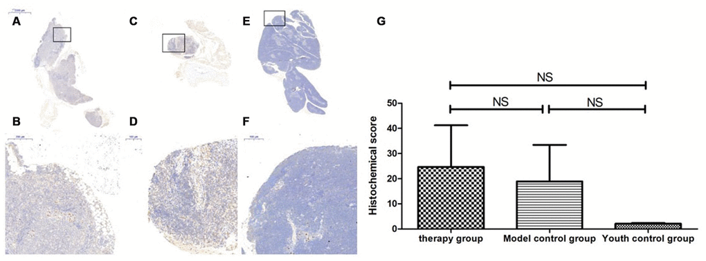 Sirt1 expression level in the mouse thymus after treatment with mUCMSCs. Note: (A, B) show immunohistochemical staining of Sirt1 in the thymus tissue after 1 month of treatment in the treatment group. The levels of Sirt1 were increased to different degrees in the treatment group. (C, D) show Sirt1 immunohistochemical staining of the mouse thymus tissue in the model control group. (E, F) show immunohistochemical staining of thymus Sirt1 in young control mice. (G) shows the difference in Sirt1 expression in mouse thymus tissue between different groups after mUCMSC treatment. All dark brown tissue sections were strongly positive, brownish-yellow staining was moderately positive, pale yellow staining was weakly positive, and blue nuclei were negative. *** indicates p  0.05.