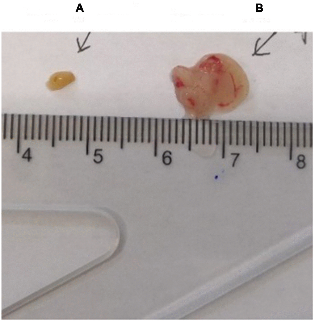 Comparison of the thymus in C57 mice of different ages. (A) model control group; (B) young control group.