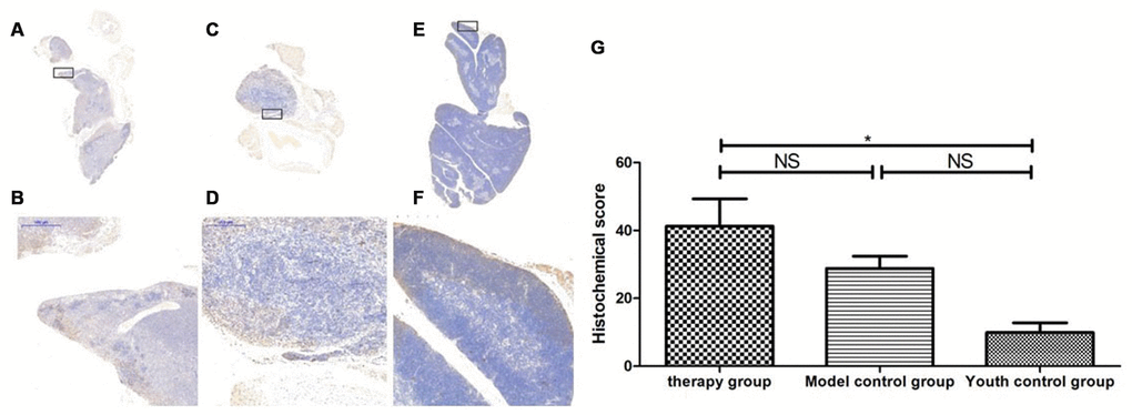 Expression of becline1 in the mouse thymus after treatment with mUCMSCs. Note: (A, B) show immunohistochemical staining of thymus becline1 in young control mice. (C, D) show immunohistochemical staining of thymus tissue becline1 in the treatment group after treatment for 1 month. (E, F) show immunohistochemical staining of becline1 in the mouse thymus tissue of the model control group. (G) shows the difference in the expression of becline1 in mouse thymus tissue between different groups after mUCMSC treatment. All dark brown tissue sections were strongly positive, brownish-yellow staining was moderately positive, pale yellow staining was weakly positive, and blue nuclei were negative. *** indicates p  0.05. Becline1 activity was lowest in the young control group and highest in the treatment group, while the model control group showed intermediate activity.