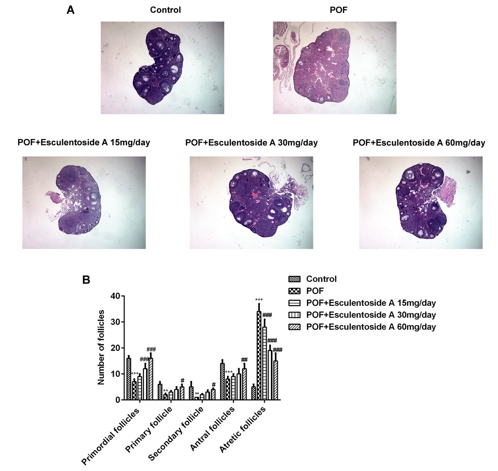 Effect of Esculentoside A (EA) on follicle growth and ovulation in POF mice. (A) Representative picture of ovaries stained by H&E. (×400 magnification). (B) The mean number of primordial follicles, primary follicles, secondary follicles, antral follicles and atretic follicles. The data were expressed as means ± SD (n =5). ***P vs. Control. #P ##P ###P vs. POF.