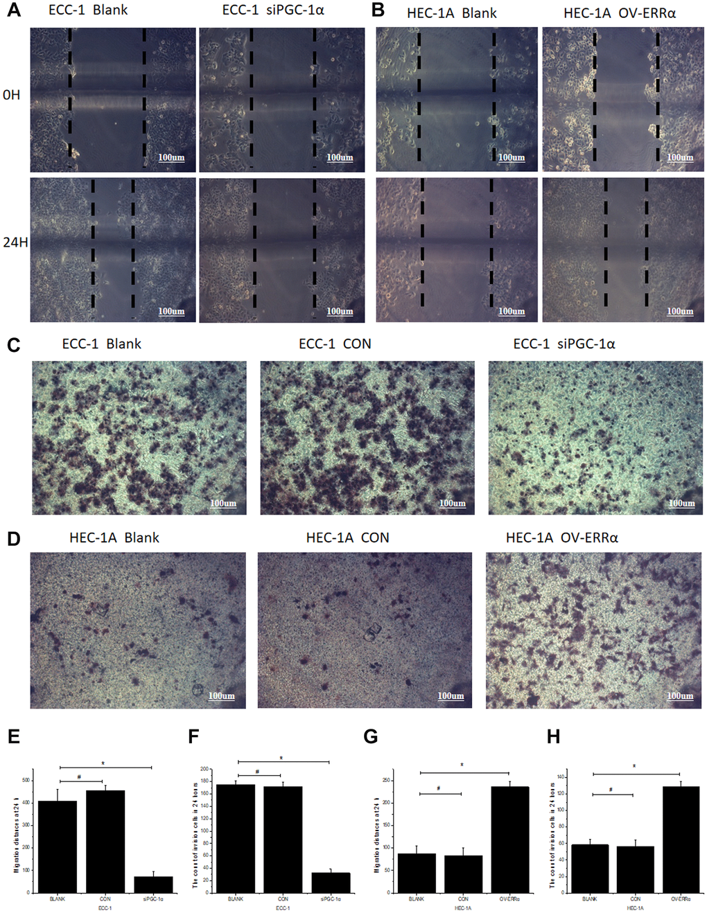 Regulation of the migration and invasion ability of endometrial cancer cells by PGC-1α and ERRα. (A) Compared with blank groups (Blank), the 24-hour migrated distances of ECC-1 siPGC-1α group were significantly reduced. (B) Compared with blank groups (Blank), the 24-hour migrated distances of HEC-1A OV-ERRα group were significantly increased. (C) The endometrial cancer cells penetrated the Transwell membrane were significantly reduced in ECC-1 siPGC-1α group compared with Blank group. (D) the endometrial cancer cells penetrated the Transwell membrane were significantly increased in HEC-1A OV-ERRα group compared with Blank. Quantification of migration (E) and invasion (F) of ECC-1 cells. Quantification of migration (G) and invasion (H) of HEC-1A cells. *mean P0.05.