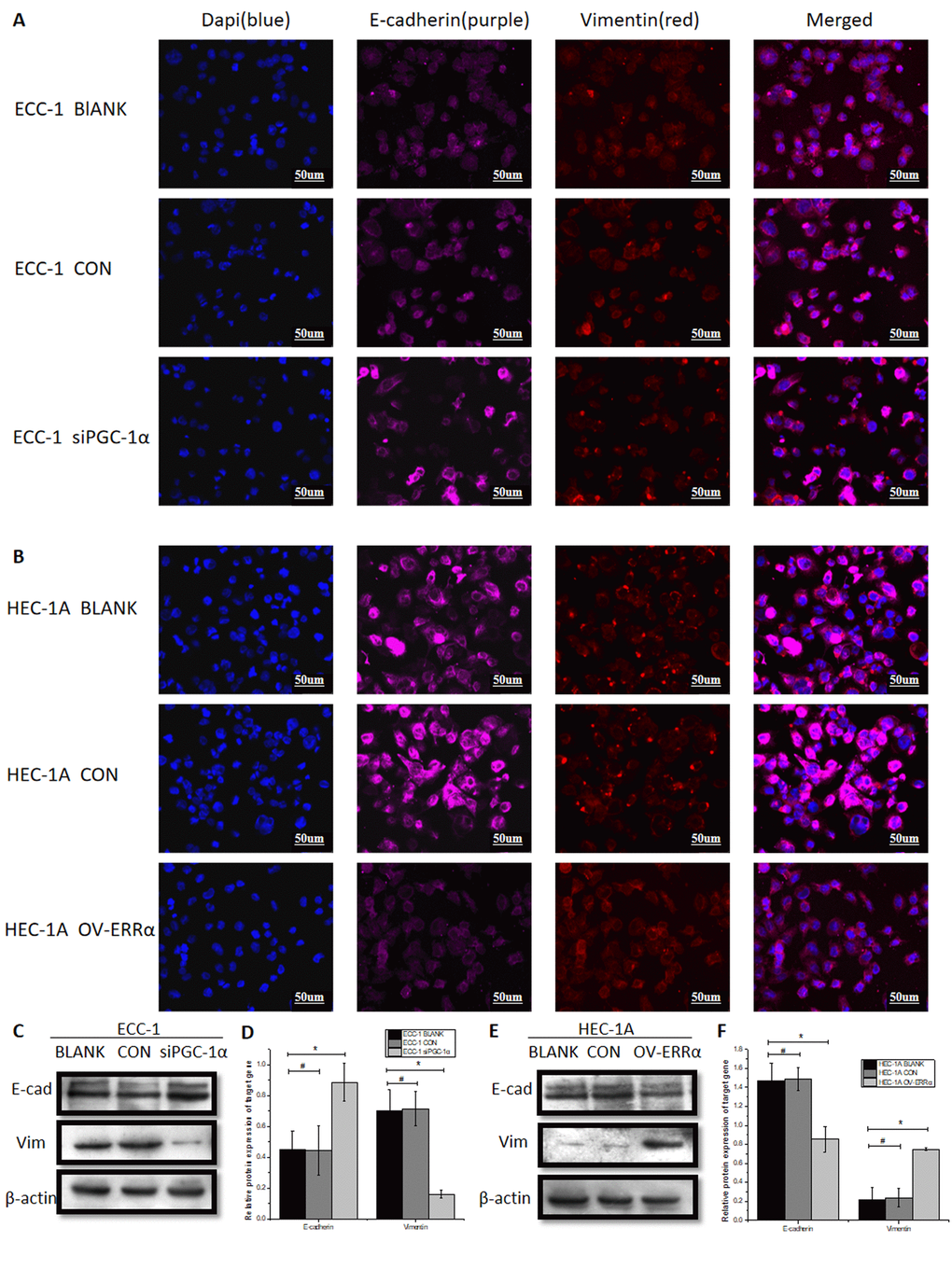 Up-and down-regulation of PGC-1α and ERRα alter the EMT process in EC cells. (A) the representative immunofluorescence images of E-cadherin (purple) and vimentin (red) in ECC-1cells and siPGC-1α-ECC-1cells. The nucleus is blue. optical microscope and fluorescence microscopic with a magnification of 400. (B) the representative immunofluorescence images of E-cadherin (purple) and vimentin (red) in HEC-1A cells and OV-ERRα cells. (C) The protein of E-cadherin and vimentin were measured by Western blot analysis in ECC-1cells and siPGC-1α-ECC-1cells. (D) Quantification of E-cadherin and vimentin protein in ECC-1 cells. (E) The protein of E-cadherin and vimentin were measured by Western blot analysis in HEC-1A cells and OV-ERRα cells. (F) Quantification of of E-cadherin and vimentin protein in HEC-1A cells. *mean P0.05.