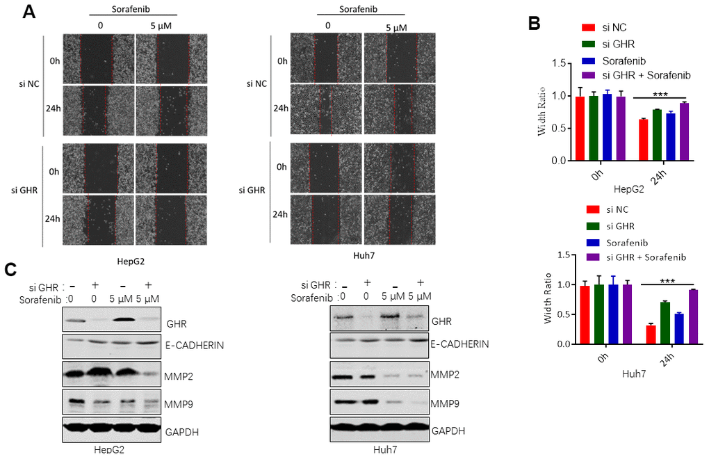 GHR knockdown enhanced sorafenib inhibiting of cell migration. (A) Wound healing assay measured cell migration of HCC cells siGHR or/and sorafenib; (B) the width ratio was calculated by the wound width/the distance measured at 0 h. All data shown represented the mean ± SEM. ***pC) The results of western blotting assay showed that GHR knockdown and sorafenib combination suppressed the protein levels of MMP2 and MMP9 and promoted the expression of E-cadherin in HepG2 and Huh7 cells.