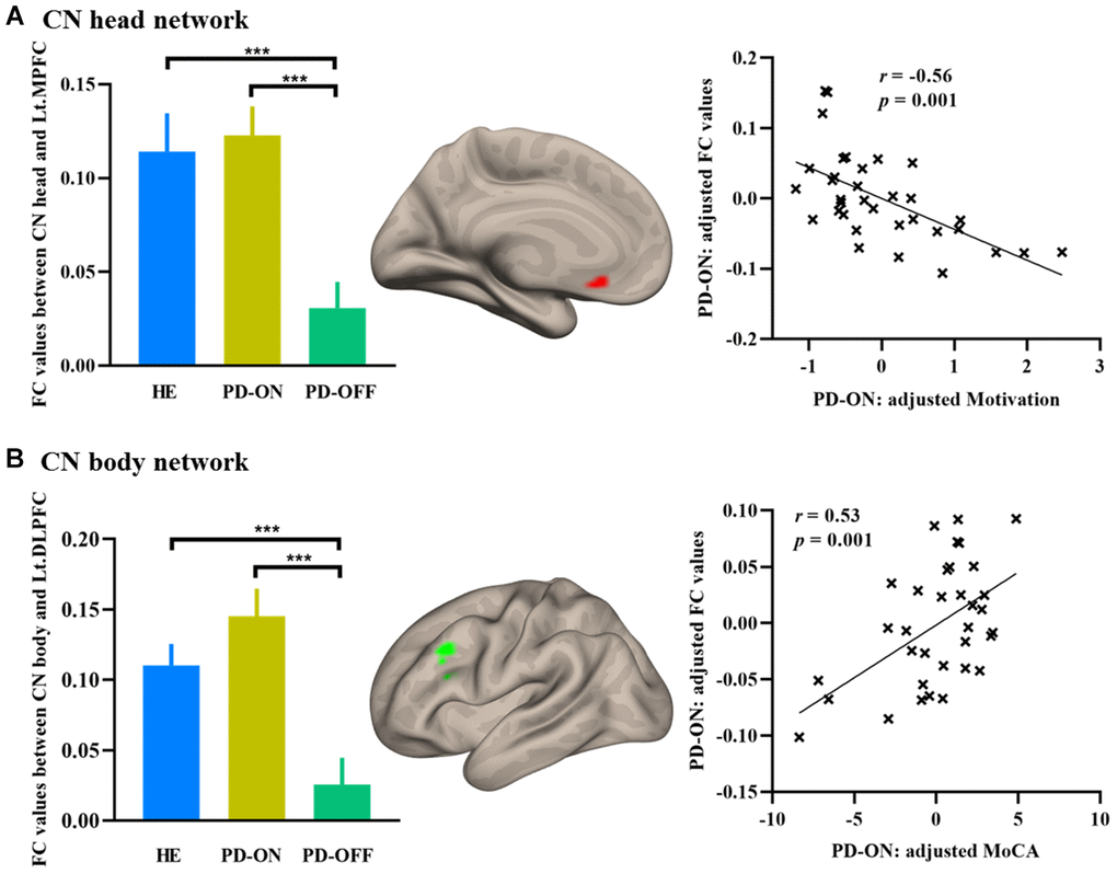 Increased FC in PD ON-medication. (A) Increased FC in the MPFC in CN head network; (B) Increased FC in the DLPFC in CN body network. Bar graphs showed the extracted FC values in HE and PD. Scatterplots showed the relationship between FC values and neuropsychological measurements. Abbreviations: FC, functional connectivity; MPFC, medial prefrontal cortex; DLPFC, dorsolateral prefrontal cortex; MoCA, Montreal Cognitive Assessment; HE, healthy elderly; PD-OFF, PD OFF-medication; PD-ON, PD ON-medication. ***, p 