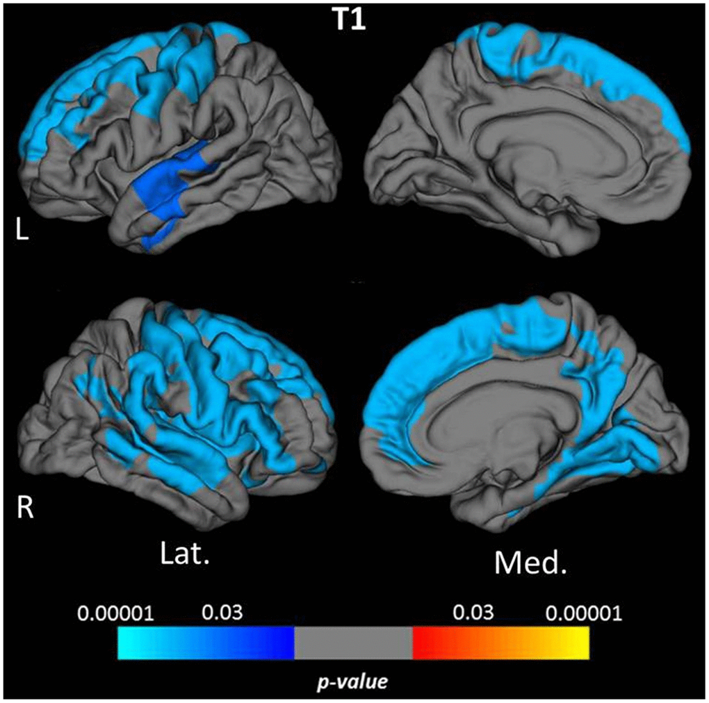 Cortical clusters indicating a significant association between age and cortical quantitative T1 values. The scale bar displays the level of significance. Cold colors demonstrate a negative association with age in the respective regions. L: left; R: right; Lat.: lateral; Med.: medial.