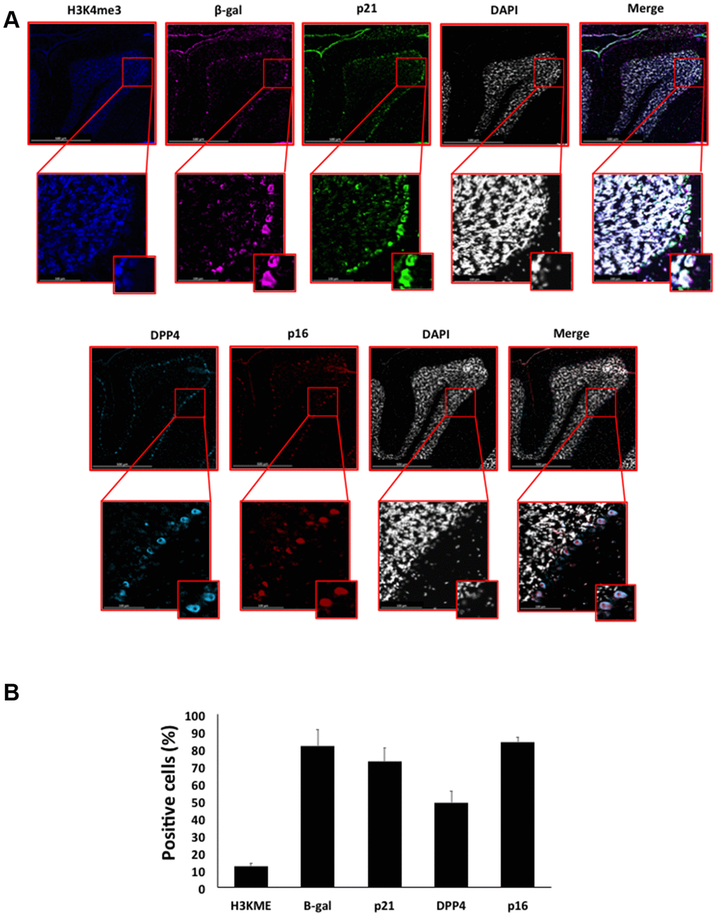 (A) Immunofluorescent staining of senescence markers in Purkinje cells of 9 months old C57/Bl6J mouse cerebellar cortex. Images display H3K4me3 (blue), β-gal (purple), p21 (green), DPP4 (cyan) p16 (red) and DAPI-stained nuclei (white) fluorescence signals. The corresponding multichannel overlaid images are shown in the right column. All these markers, except H3K4me3, show an increased localization and expression in Purkinje cells. Representative images from 3 different mice are shown. (B) Frequency of positive cells for each marker as in (A), indicated in %.