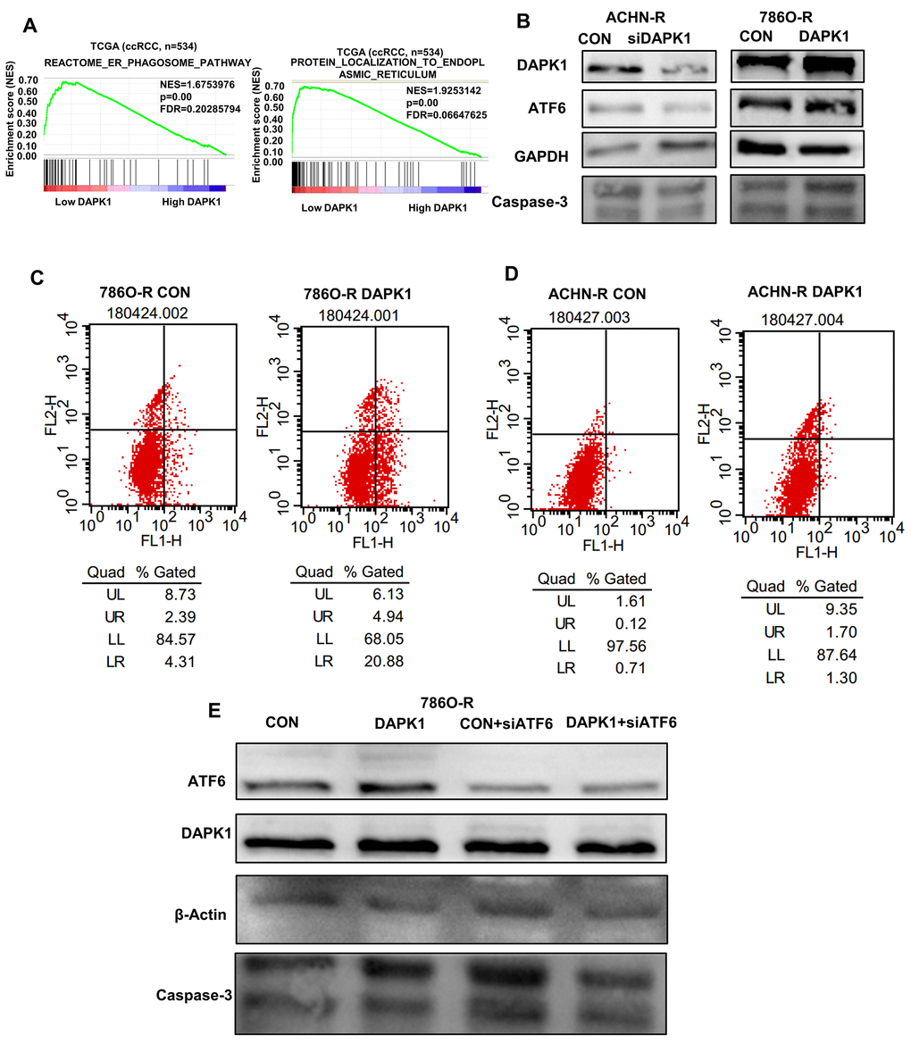 DAPK1 regulates endoplasmic reticulum stress-mediated apoptosis. (A) GSEA shows that DAPK1 expression correlates with reactome
