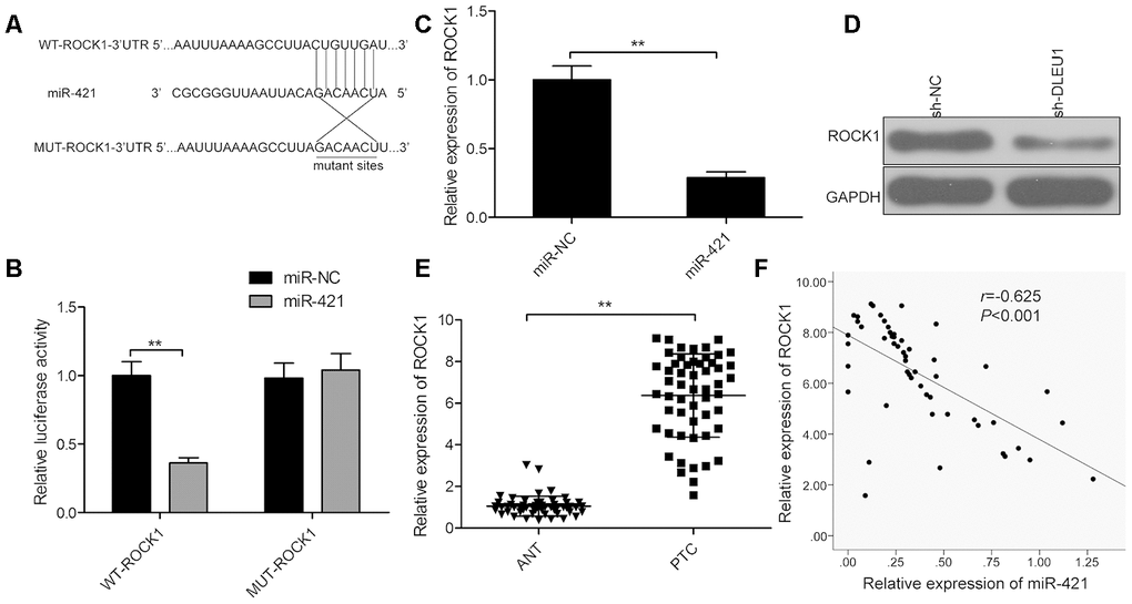 ROCK1 is a direct target of miR-421 in PTC cells. (A) The predicted miR-421 binding sites in the 3’UTR of ROCK1 and the mutated sequence are shown. (B) Dual luciferase reporter assay shows the relative luciferase activity in TPC-1 cells co-transfected with miR-421 mimic or miR-NC and luciferase reporter plasmid with wild-type ROCK1-3’-UTR (WT-ROCK1) or mutant ROCK1-3’-UTR (MUT-ROCK1). (C) QRT-PCR analysis shows the ROCK1 mRNA levels in miR-NC- and miR-421 mimic-transfected TPC-1 cells. (D) Western blot analysis shows ROCK1 protein levels in miR-NC- and miR-421 mimic-transfected TPC-1 cells. (E) QRT-PCR analysis shows ROCK1 mRNA expression in 54 paired PTC and adjacent normal thyroid tissues. (F) Spearman correlation analysis shows that ROCK1 expression is inversely related to miR-421 expression in PTC tissues (n=54). Note: The data are represented as the means ± SD of at least three independent experiments. *PP