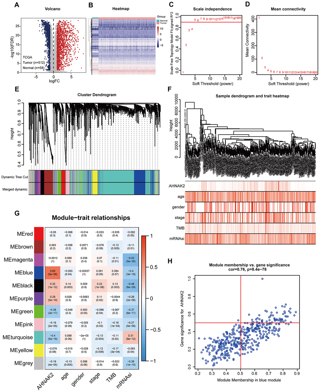 Screening for modules and genes related to AHNAK2 in PTC. (A) Volcano plot of DEGs between PTC and adjacent tissues in TCGA data. (B) Heatmap of DEGs between PTC and adjacent tissues in TCGA data. (C) Calculation of the scale-free fit index of various soft-thresholding powers (β). (D) Analysis of the mean connectivity of various soft-thresholding powers (β). (E) Clustering dendrogram of 475 PTC patients. (F) A total of 2696 DEGs were clustered based on the dissimilarity measure (1-TOM) and were divided into 11 modules. (G) A correlation heatmap between module eigengenes and clinical parameters (AHNAK2 was used as the main research object) of PTC. (H) Scatter plot of blue module eigengenes.