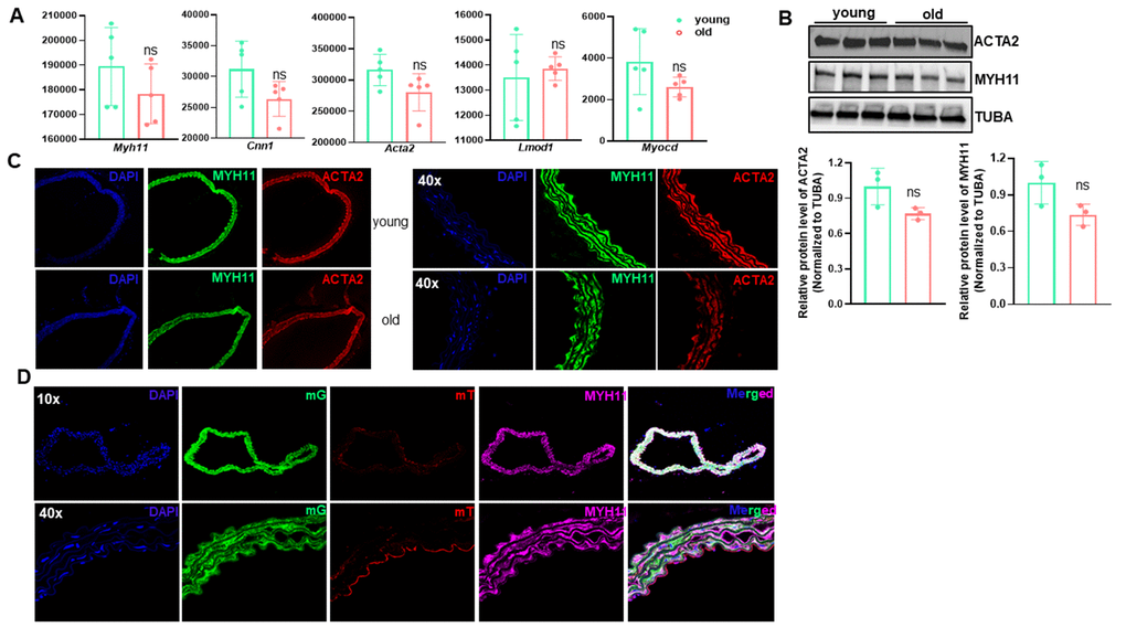 The contractile vascular smooth muscle cell (VSMC) phenotype is retained in old aortae. (A) Normalized counts of SMC marker genes in young and old mouse aortae. Data are presented as a scatterplot of individual points with mean±SD, n=5. ns, not significant compared to young aortae, unpaired two-tailed Student's t-test. (B) Western blotting for the indicated SMC marker proteins in total protein lysates of young and old mouse aortae and its quantitation (n=3). (C) Representative confocal microscopy images of immunofluorescence staining for MYH11 and ACTA2 in aortae of young and old C57/BL6 mice. (D) Representative confocal microscopy images of immunofluorescence staining for MYH11 and ACTA2 together with fluorescence of membrane Tomato (mT, Red) and membrane GFP (mG, Green) in young and old Myh11-Cre-ERT/mTmG reporter mice. Mice (14 wks) were injected with tamoxifen (TMX) for 5 consecutive days (n=4) and aortae were isolated at the age of 54 wks. Upon TMX induction, all mature SMCs were labeled by mG, whereas other cell types were labeled by mT.