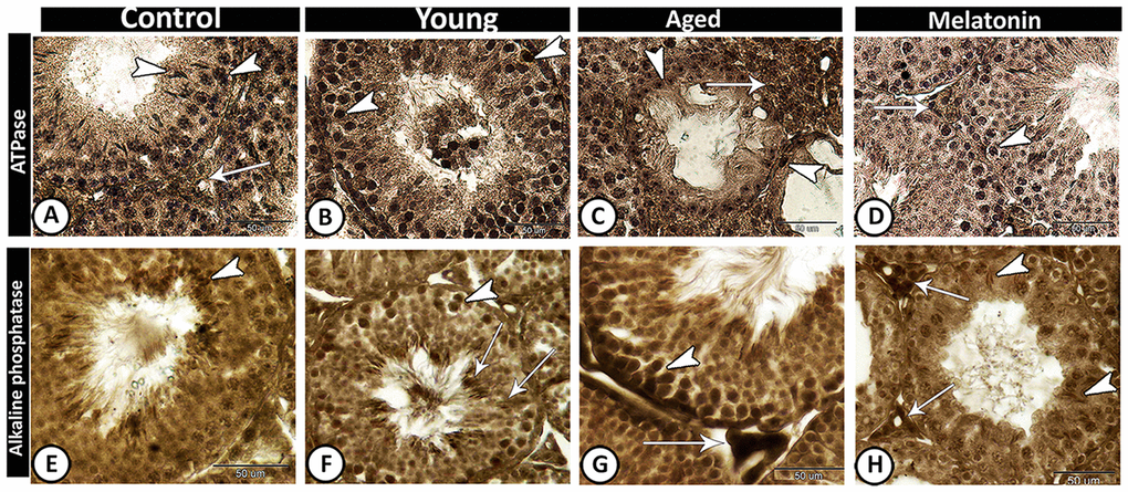 Enzyme histochemistry in the young and aged mice. (A, D) In both control and melatonin groups, ATPase activities increased in Leydig cells (arrow) and active germ cells (arrowheads). (B) ATPase activities were concentrated in spermatogonia and spermatocytes (arrowheads) in young mutant mice. (C) In the aged mice, the staining reaction increased in interstitial cells (arrow) and some spermatogonia (arrowheads). (E) In control, alkaline phosphatase staining was detected in the elongated spermatids (arrowhead). (F) In young mutant mice, the reaction was intense in the germ cells (arrowhead) and Sertoli cells and their associated spermatids (arrows). (G) In aged mutant mice, the activity increased in spermatogonia and spermatocytes (arrowhead) and the Leydig cells showed high acid phosphatase activity (arrow). (H) In the melatonin group, alkaline phosphatase activity was detected in the active Sertoli cells (arrowheads) and Leydig cells (arrows).