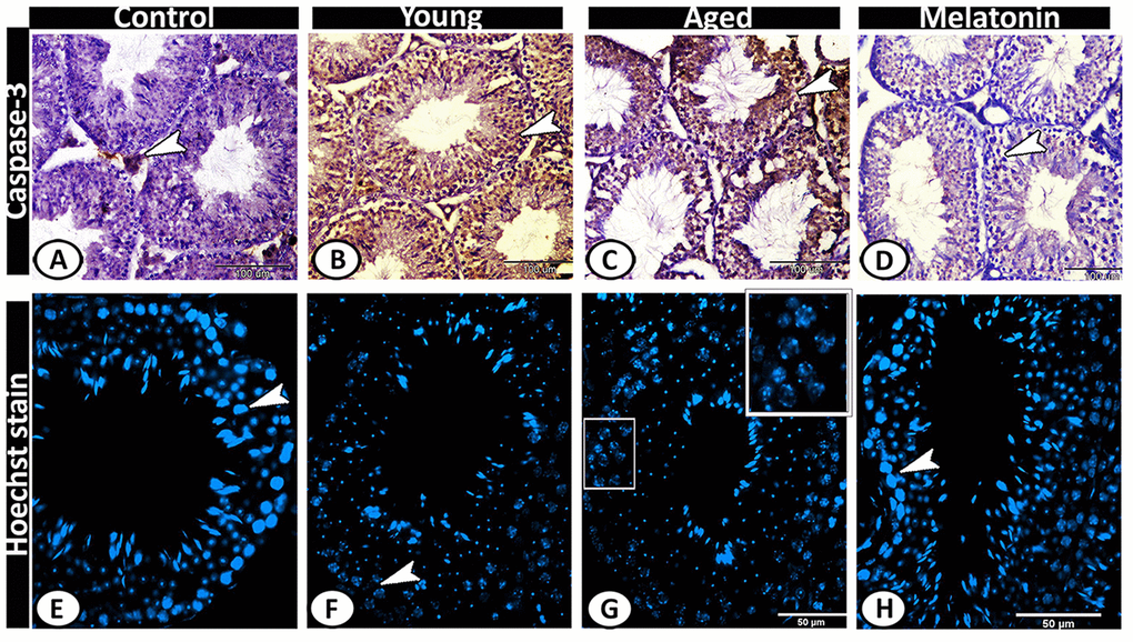Detection of testicular apoptosis of the young and aged mice. (A) Caspase 3 was immunolocalized in Leydig cells (arrowhead) of the control group. (B, C) in both young and aged mutant mice showed overexpression of Caspase 3 in the seminiferous tubules and interstitium (arrowheads). (D) In the melatonin group, Caspase 3 immunostaining in seminiferous tubules showed a normal pattern of apoptosis (arrowhead). (E, H) The Hoechst immunofluorescent stain showed normal spermatogenic activity (arrowheads) in both the control and melatonin groups. (F, G) The spermatogenic cells of the young and aged mutant mice showed nuclear fragmentation, condensation, and hyperchromatasia (arrowhead, boxed areas).