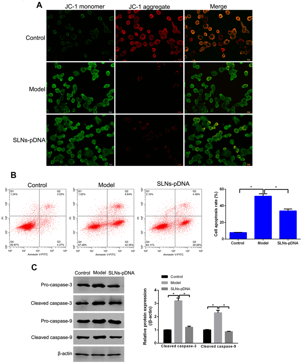 Solid lipid nanoparticles-integrin β1 overexpression plasmid (SLNs-pDNA) inhibited cell apoptosis in IL-1β-induced rat chondrocytes. (A) The mitochondrial membrane potential of rat chondrocytes treated with IL-1β (model group), or IL-1β + SLNs-pDNA (SLNs-pDNA group). (B) Cell apoptosis rate in rat chondrocytes treated with IL-1β (model group), or IL-1β + SLNs-pDNA (SLNs-pDNA group) by flow cytometry analysis. (C) The expression of apoptosis-related proteins, including cleaved caspase-3, and cleaved caspase-9 in rat chondrocytes treated with IL-1β (model group), or IL-1β + SLNs-pDNA (SLNs-pDNA group) by western blotting. *P 