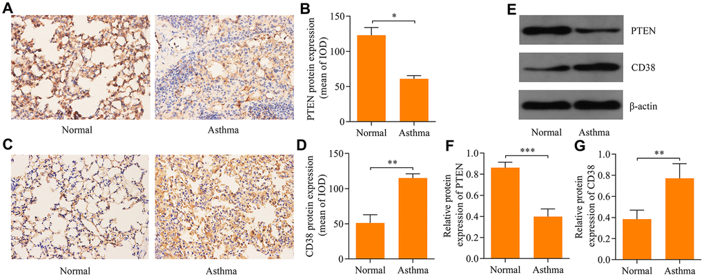 Expression of PTEN and CD38 in lung tissues of asthmatic mice. Immunohistochemistry used to assess expression of (A, B) PTEN and (C, D) CD38 proteins in the lung tissue of asthmatic mice (magnification: 400X). (E) Western blot used to assess protein expression levels of PTEN and CD38 in the lung tissue of asthenic mice. Quantitative analysis of (F) PTEN and (G) CD38 protein expression determined in E (n = 3, *p 