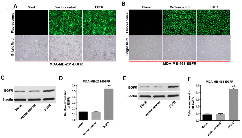 Overexpression of EGFR in TNBC cells. (A) MDA-MB-231 (B) and MDA-MB-468 cells were transfected with lenti-EGFR for 72 h. The transfection efficacy of the cells was observed under a fluorescent microscope (×200 magnification). (C–F) The expression of EGFR in MDA-MB-231 and MDA-MB-468 cells was analyzed by Western blotting. **P 