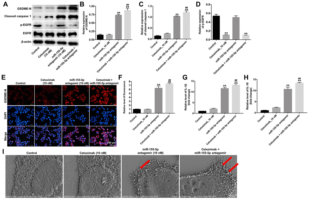 Cetuximab and miR-155-5p antagomir combination treatment induces pyroptosis in TNBC cells. EGFR-overexpressed MDA-MB-468 cells were treated with cetuximab (10 nM) and/or the miR-155-5p antagomir (10 nM) for 72 h. (A) Expression levels of GSDME-N, cleaved caspase-1, and p-EGFR in cells were detected by western blotting. (B, C) The relative expression levels of GSDME-N and cleaved caspase-1 were normalized to β-actin. (D) The relative expression level of p-EGFR in cells was normalized to EGFR. (E, F) The relative fluorescence expression levels were quantified by GSDME-N and DAPI staining. (G, H) Levels of IL-1β and IL-18 in cells were detected by RT-qPCR. (I) The ultrastructure of the cells was observed under a transmission electron microscope (TEM). Red arrowheads indicate the large bubbles emerging from the plasma membrane. **P ##P 