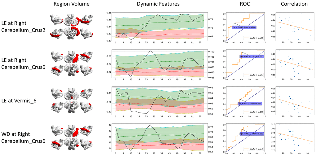 Dynamic graph attributes curves with ROC AUC plots, ROC curve at the maximum ROC AUC time point, and correlation of features and clinical scores. For Dynamic Features line plots, black line stands for ROC AUC (value on the right axis). Green stands for healthy controls and red stands for CMSA patients (value on the left axis). The ROC curve at the time point when AUC reached its maximum is shown. The correlation is between clinical score (x-axis) and features (y-axis). BC: betweenness centrality; CCFS: clustering coefficient; LE: local efficiency; WD: weighted degree.