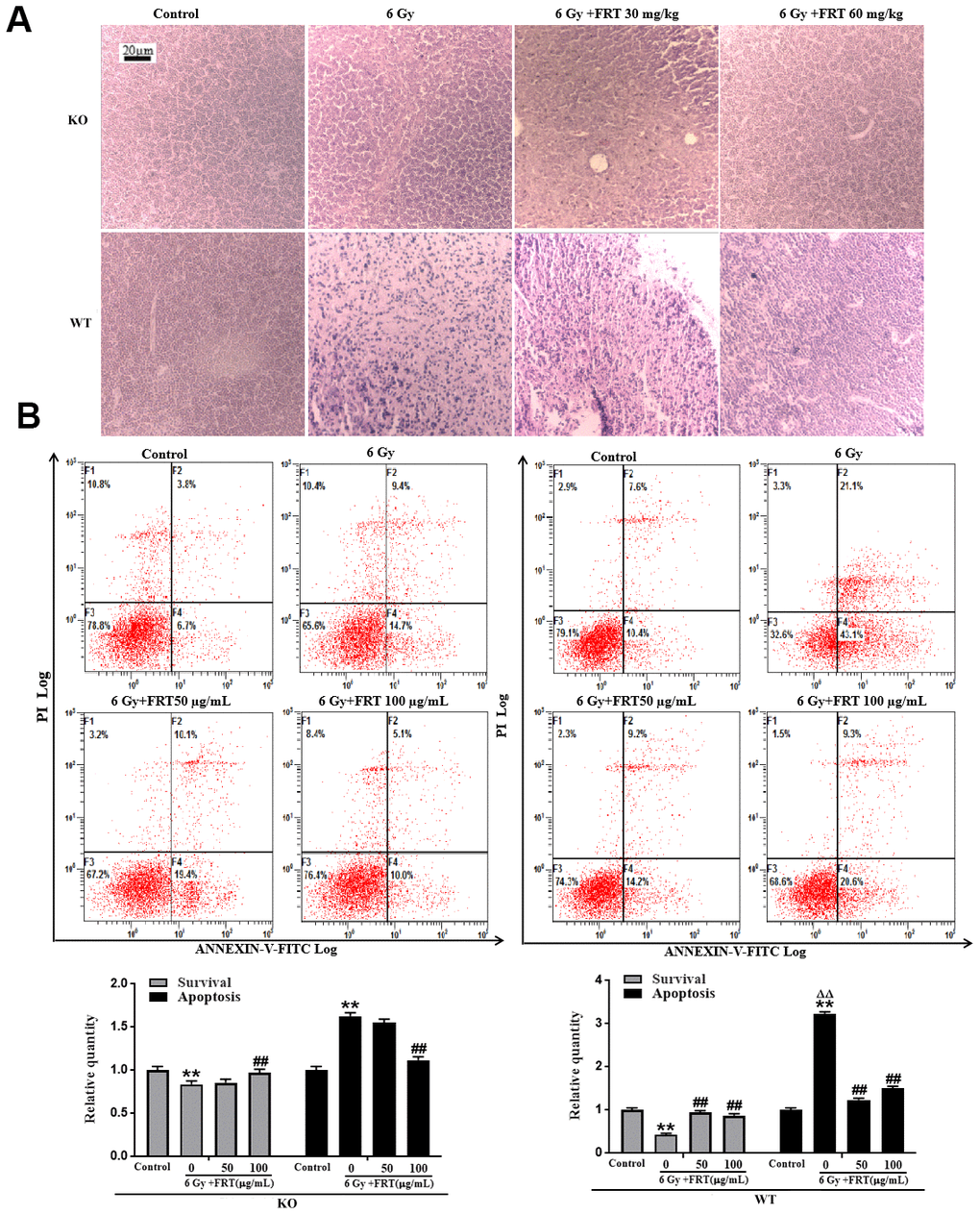 FRT significantly improved the histopathological change of thymus and reduced the rate of apoptosis after radiation by PARP-1. (A) WT and KO mice were randomly divided into 4 groups according to their body weight ① Normal group, ② Radiation group, ③ Radiation +FRT 30 mg/kg, ④ Radiation +FRT 60 mg/kg). Mice were given different doses of FRT by gastrointestinal administration for 4 days, and were irradiated at the dose of 6 Gy. Thymus was removed 4 days after irradiation. The tissues were fixed overnight with 4% paraformaldehyde, and then embedded in paraffin. After sectioning, the tissues were stained with hematoxylin and eosin (n=5). (B) Thymus cells were pretreated with or without FRT (50 and 100 μg/mL) prior to 6 Gy irradiation. Cells were harvested, and apoptosis was assessed by FCM (staining with both Annexin V-FITC and PI) 6 h after irradiation. The percentages of survival cells were compared (** PP