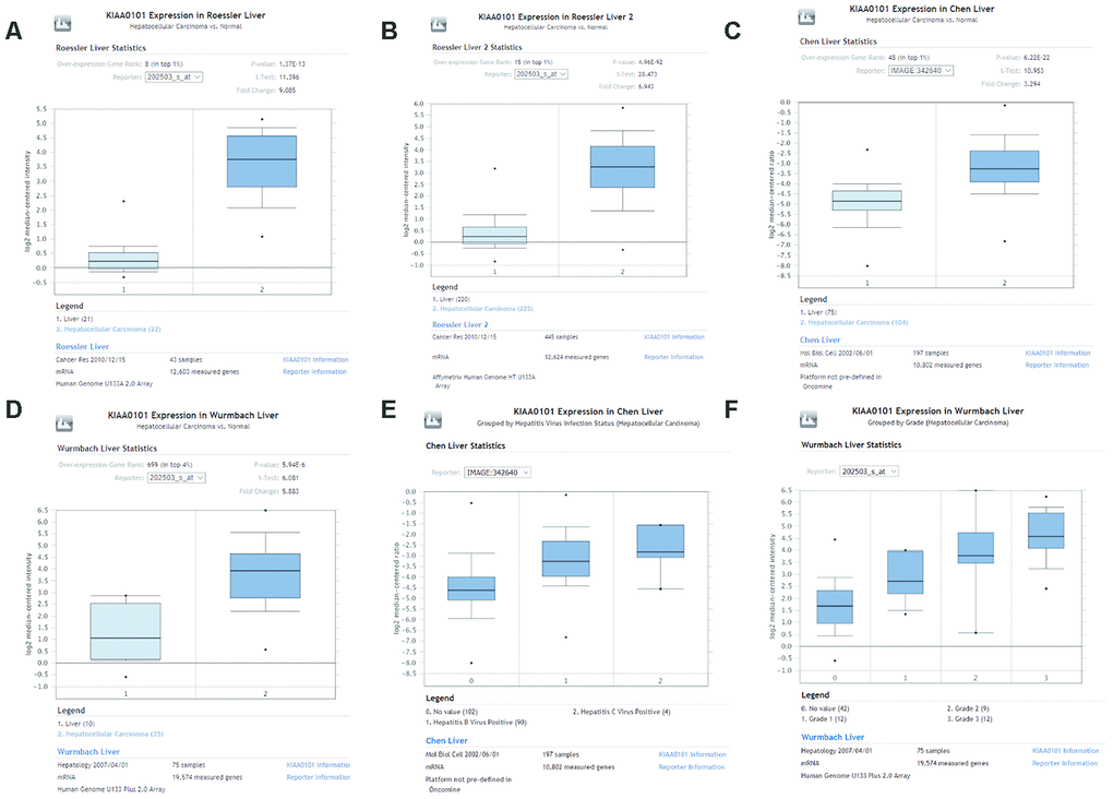 Comparison of KIAA0101 mRNA levels between HCC and normal counterparts by the four unique analyses of ONCOMINE. (A) Comparison of KIAA0101 mRNA levels between noncancer tissues and HCC tumors in Roessler’s study based on Human Genome U133A 2.0 Array in the ONCOMINE database. KIAA0101 presented significantly higher expression in HCC tissues than in noncancer tissues (p=1.37E-13). (B) Comparison of KIAA0101 mRNA levels between noncancer tissues and HCC tumors in Roessler’s study based on the platform of Affymetrix Human Genome HT U133A Array in the ONCOMINE database. KIAA0101 expression was significantly higher in HCC tissues than in noncancer tissues (p=4.96E-92). (C) Comparison of KIAA0101 mRNA levels between noncancer tissues and HCC tumors in Chen’s study in the ONCOMINE database. KIAA0101 presented significantly higher expression in HCC tissues than in noncancer tissues (p= 6.22E-22). (D) Comparison of KIAA0101 mRNA levels between noncancer tissues and HCC tumors in Wurmbach’s study, which was identified in the ONCOMINE database. KIAA0101 presented significantly higher expression in HCC tissues than in noncancer tissues (p= 5.94E-6). (E) KIAA0101 expression in HCC grouped by virus infection status. The HCC samples were no value (102 samples), HBV positive (90 samples), and HCV positive (4 samples) in Chen’s liver dataset. (F) KIAA0101 expression in HCC grouped by tumor grade. The HCC samples are no value (42 samples), grade 1 (12 samples), grade 2 (9 samples), and grade 3 (12 samples) in Wurmbach’s liver dataset. Abbreviations: HCC: hepatocellular carcinoma; HBV: hepatitis B virus; HCV: hepatitis C virus.