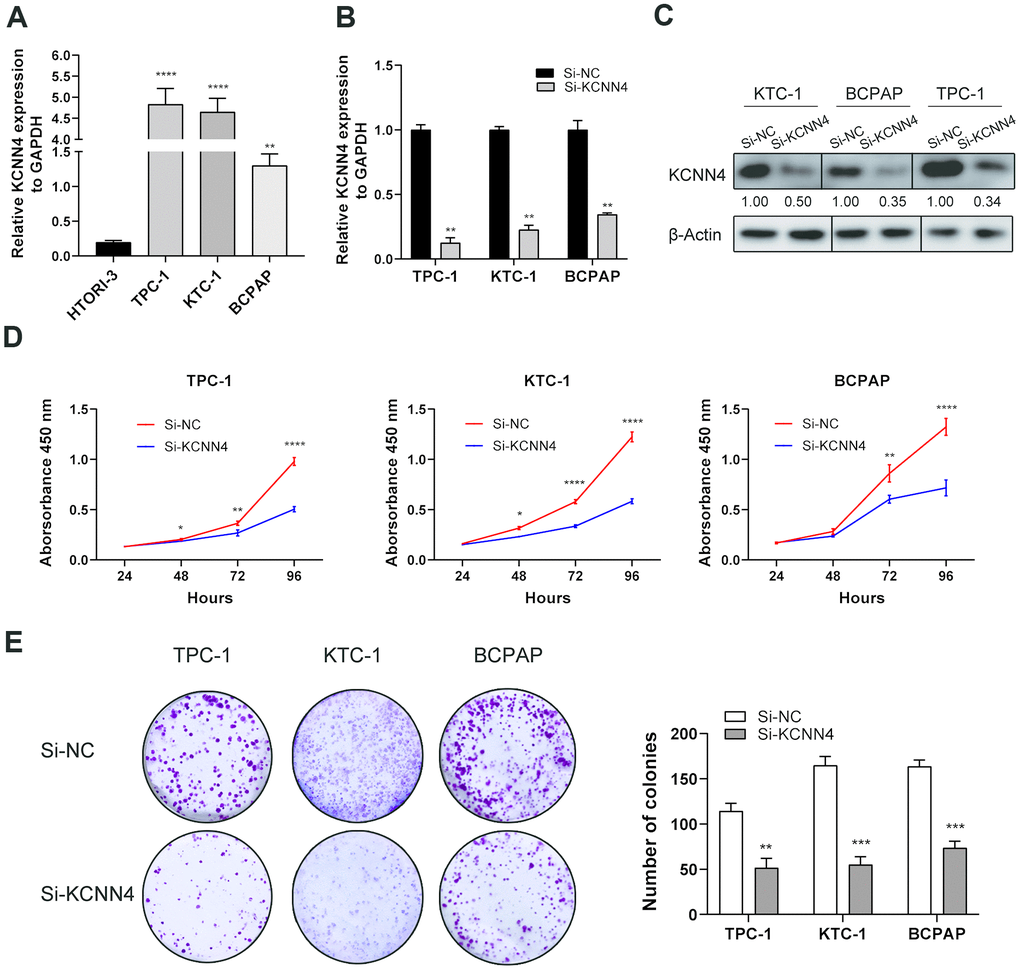 KCNN4 was upregulated in PTC cell lines and promoted their proliferation in vitro. (A) The relative expression of KCNN4 in PTC cell lines (compared with GAPDH). KCNN4 was upregulated in three PTC cell lines (KTC-1, TPC-1 and BCPAP) compared to the normal thyroid cell line HTORI-3. (B) KCNN4 expression was lower in the Si-KCNN4 group than in the Si-NC group in the three PTC cell lines. (C) KCNN4 protein expression was lower in the Si-KCNN4 group than in the Si-NC group. (D, E) CCK-8 assays and colony formation assays in the three PTC cell lines. Two-way analysis of variance was used to analyze the CCK-8 assay data, and Student’s t-test was used for the others. *pppp