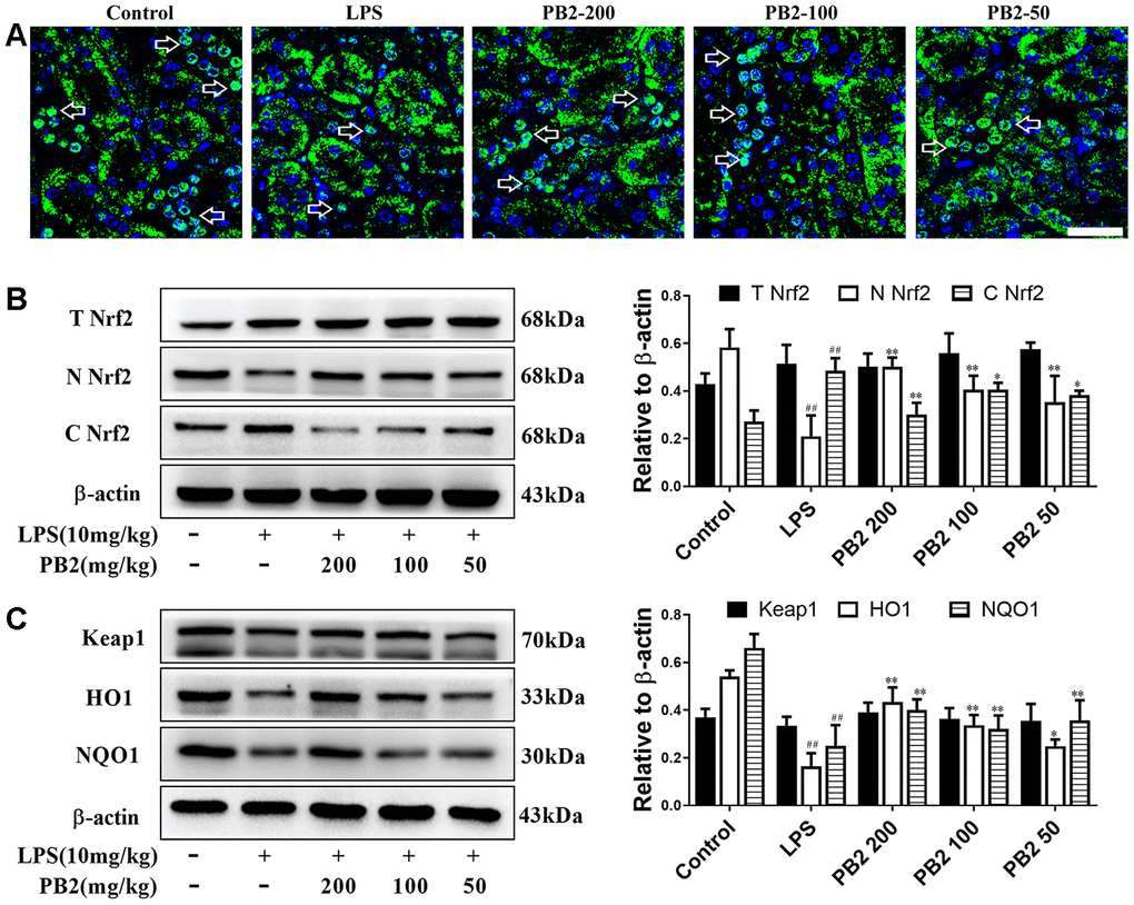 Effects of PB2 on Nrf2 translocation into nucleus (n = 8). IF of Nrf2 (Bar = 50 μm) (A); total Nrf2 and nuclear/cytosolic Nrf2 (B), Keap1, HO1 and NQO1 and semi-quantification (C). #P ≤ 0.05, ##P ≤ 0.01 compared to control mice; *P ≤ 0.05, **P ≤ 0.01 compared to LPS challenged alone.