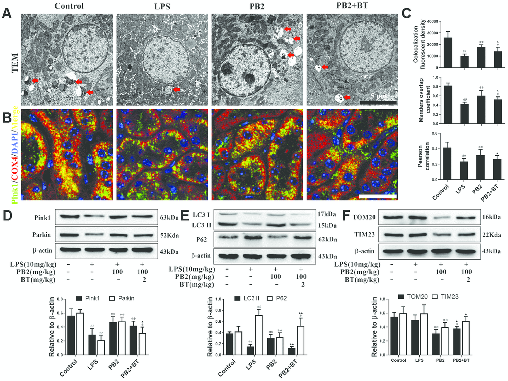 Improved mitophagy depend on Nrf2 translocation (n = 8). Mitochondrial structure in renal tubular epithelial (Bar = 5 μm) (A); co-localization of anti-Pink1 (green)/anti-COX IV (red) antibodies (B) (Bar = 25 μm); the co-localization fluorescence intensity, overlap coefficient and Pearson's correlation of Pink1-COX IV (C); expressions of Pink1, parking, LC3, p62, TOM20 and TIM23, semi-quantification (D–F). #P ≤ 0.05, ##P ≤ 0.01 compared to control mice; *P ≤ 0.05, **P ≤ 0.01 compared to LPS challenged alone; ▲P ≤ 0.05, ▲▲P ≤ 0.01 between PB2 and PB2+BT.