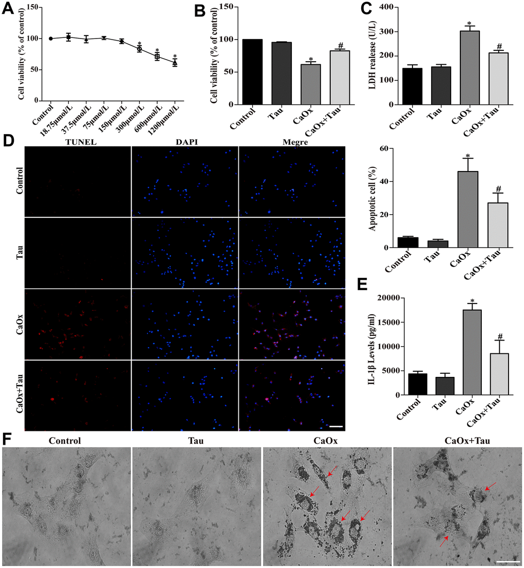 Tau ameliorated CaOx crystals-induced HK-2 cell injury. (A) Effect of Tau on the viability of HK-2 cells. (B) Effect of Tau on the viability of cells exposed to CaOx crystals. (C) The concentration of secreted LDH in cell supernatants. (D) The apoptosis of HK-2 cells was assessed using TUNEL assay; scale bar: 50 μm. (E) ELISA detection of IL-1β expression in culture supernatants. (F) Observation of the crystal adhesion on HK-2 cells under a light microscope. Red arrows indicate intracellular CaOx crystals; scale bar: 20 μm. Data are presented as the mean ± SD (n=3). *P #P 