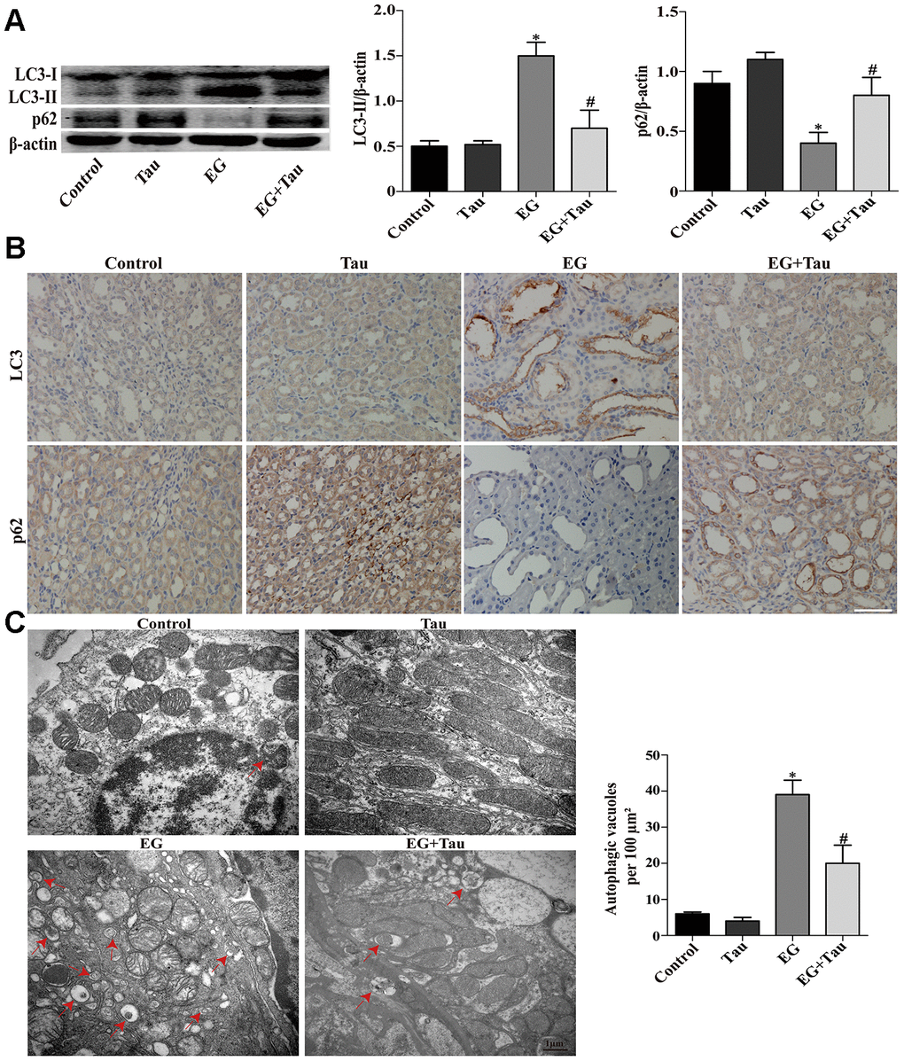 Effects of Tau on EG-induced autophagic activity in rat kidneys. (A) The levels of LC3-II and p62 were examined by Western blot. (B) The expressions of LC3 and p62 in kidney tissues were detected by immunohistochemical staining; scale bar: 100 μm. (C) Detection of autophagic vacuoles in renal tissues by TEM. Red arrows: autophagic vacuoles; scale bar: 1 μm. Data are presented as the mean ± SD (n=3). *P #P 