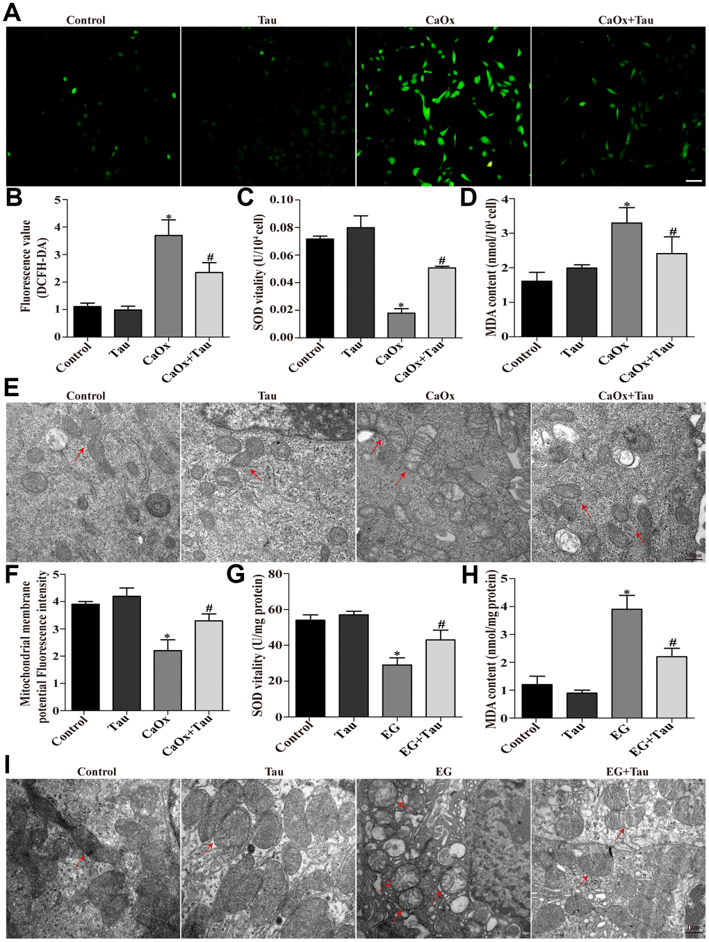 Tau alleviates oxidative injury induced by CaOx crystals. (A) The ROS level in HK-2 cells after different treatments was examined using DCFH-DA; scale bar: 50 μm. (B) Quantitative analyses of DCFH-DA assay. (C and D) Effects of Tau on SOD and MDA levels in cells treated with CaOx crystals. (E) The ultrastructural morphology of the was detected by TEM. Red arrows: mitochondria; scale bar: 500 nm. (F) Mitochondrial membrane potential of all groups of cells. (G and H) Effects of Tau on SOD and MDA levels in EG-induced renal tissues. (I) The ultrastructural morphology of mitochondria in renal tissues was detected by TEM. Red arrows: mitochondria; scale bar: 1 μm. Data are presented as the mean±SD (n=3). *P #P 