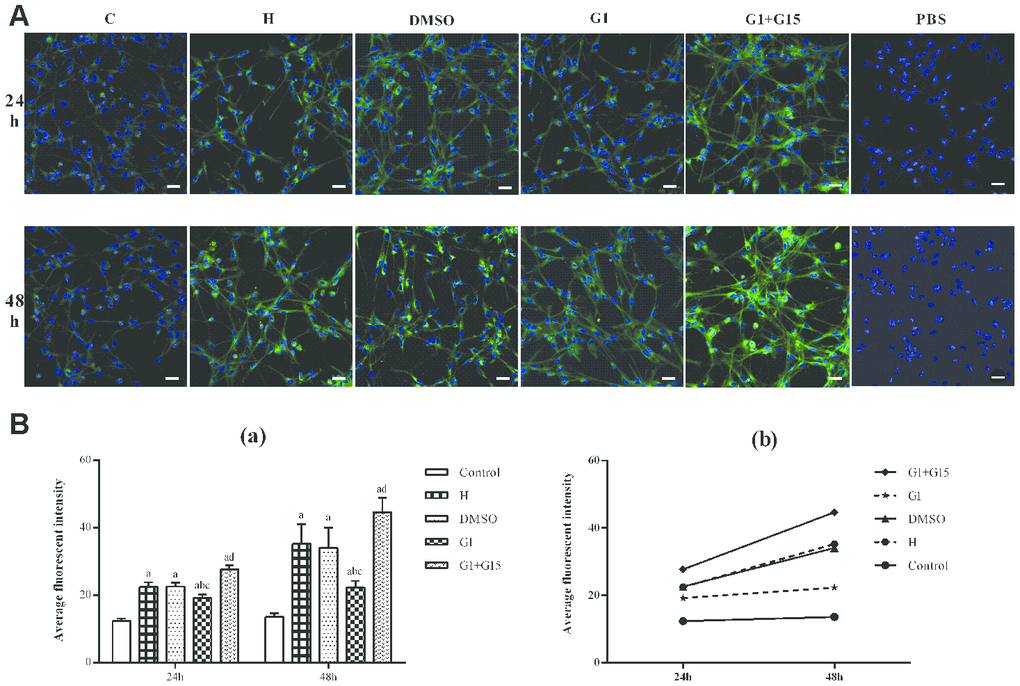 GPER activation reduces autophagy in hyperoxia-treated primary retinal microglia. (A) Representative confocal fluorescence images (400×, Bar=25μm) show Cyto-ID labeled autophagic vesicles (green) in the (a) control (C), (b) hyperoxia (H), (c) hyperoxia+DMSO (DMSO), (d) hyperoxia+G-1 (G-1), and (e) hyperoxia+G-1+G-15 (G-1+G-15) groups of primary retinal microglia at 24 and 48 h. The negative control cells were treated with PBS instead of Cyto-ID. (B) Histogram plots show average fluorescence staining intensity (Cyto-ID; green) at 24 and 48 h in the (a) control (C), (b) hyperoxia (H), (c) hyperoxia+DMSO (DMSO), (d) hyperoxia+G-1 (G-1), and (e) hyperoxia+G-1+G-15 (G-1+G-15) groups at 24 and 48 h. P