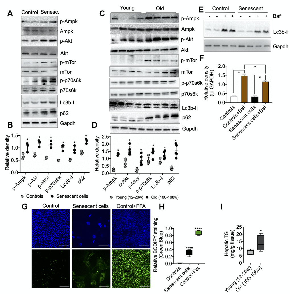 Molecular analysis of energy-sensing pathways in senescent AML12 cells and liver tissues from young and old mice. (A) Western blot analysis of energy sensing and autophagic proteins including GAPDH in control and senescent AML12 cells. (B) Relative densitometric values of Western blots were calculated using ImageJ (NIH) software and normalized to GAPDH (n=3). (C) Western blot analysis of energy sensing and autophagic proteins including GAPDH in liver tissue from young and old mice. (D) Relative densitometric values of Western blots were calculated using ImageJ (NIH) software and normalized to GAPDH (n=5). (E) Western blot analysis of autophagy flux using lysosome inhibitor Bafilomycin A1 (Baf) in control and senescent AML12 cells under basal condition. (F) Relative densitometric values of Western blots were calculated using ImageJ (NIH) software and normalized to GAPDH (n=3). (G) Immunofluorescence analysis of neutral lipids accumulation (fat droplets) in control and senescent AML12 cells using BODIPY stain. Images were taken at 10x magnification. Control cells were treated overnight with 0.75 mM fatty acids Oleic Acid:Palmitic Acid (2:1) as a positive control. Scale bars as 100 mm. (H) Relative BODIPY fluorescence was calculated over Hoechst 33342 fluorescence using ImageJ software (NIH). (I) Hepatic triglyceride measurement was performed in the liver tissues from young and old mice. Statistical differences were calculated significant as *p