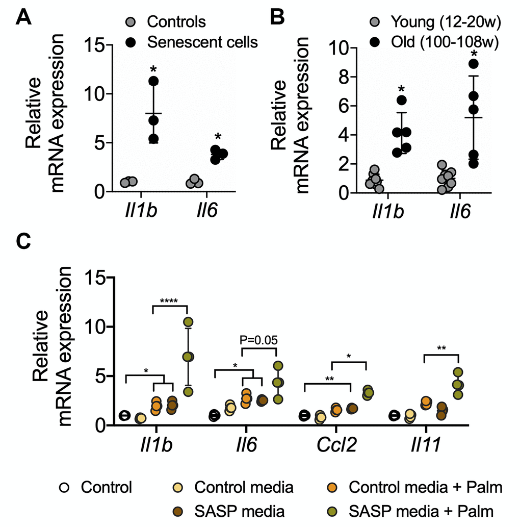 RT-qPCR analysis of SASP-related proinflammatory genes in senescent AML12 cells and liver tissues from young and old mice. RT-qPCR analysis of SASP-related proinflammatory genes in senescent AML12 cells (A) and liver tissues from young and old mice (B). (C) RT-qPCR analysis of inflammatory interleukins, chemokine CCL2 and fibrotic IL11 genes in control AML12 cells treated with conditional media from senescent AML12 cells (24 h) along with or without saturated fatty acids palmitate (0.5 mM for 24 h). Statistical differences were calculated significant as *p