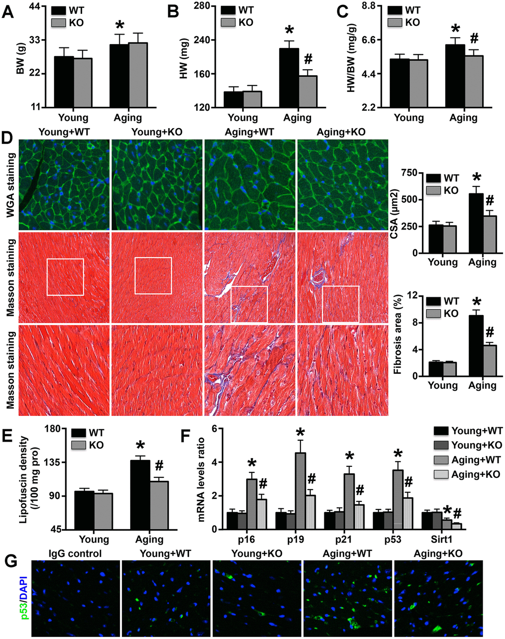 Effects of IL-6 KO on cardiac remodeling and aging-related protein levels. (A–C) Body weights (BWs), heart weights (HWs), and HW/BW ratios in the four groups. (D) MC CSA and cardiac fibrosis area in each group. (E) Lipofuscin density in each group. (F) p16, p19, p21, p53, and Sirt1 mRNA expression levels were analyzed by RT-PCR. (G) Cardiac p53 protein expression was detected by immunofluorescence staining. N=5-8 in each group. * p# p