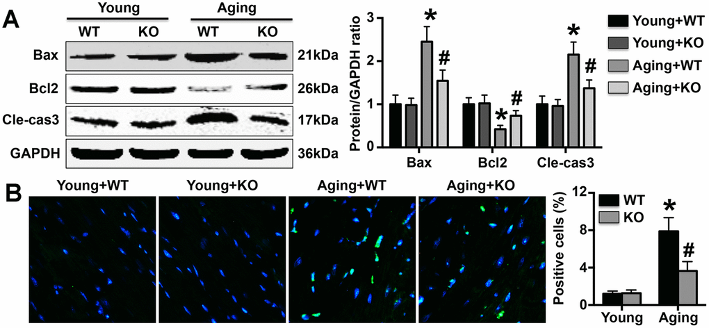 Effects on MC apoptosis. (A) The expression of apoptosis-related proteins was detected in hearts. (B) TUNEL staining was performed to mark apoptotic cells, and the number of TUNEL-positive cells in each group was determined. N=5-8 in each group. * p# p