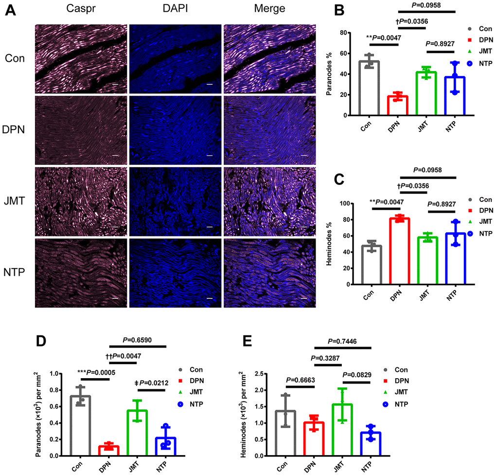 JMT protected paranodal structures in the sciatic nerves of DPN rats. (A) Representative images of longitudinal sections of sciatic nerves with immunolabeling for Caspr (pink) and counterstained with DAPI (blue, marking nuclei) at a magnification of 400×; scale bars, 20 μm. Percentage of (B) paranodes and (C) heminodes at paranodal junctions in the sciatic nerves of rats. Number of (D) paranodes and (E) heminodes per mm2 in the sciatic nerves of rats. Means ± SD; n=3/group. ***p p vs. normal control group; ††P P vs. distilled water-treated DPN group. ‡p vs. JMT-treated DPN group. One-way ANOVA followed by Tukey’s multiple comparison test.