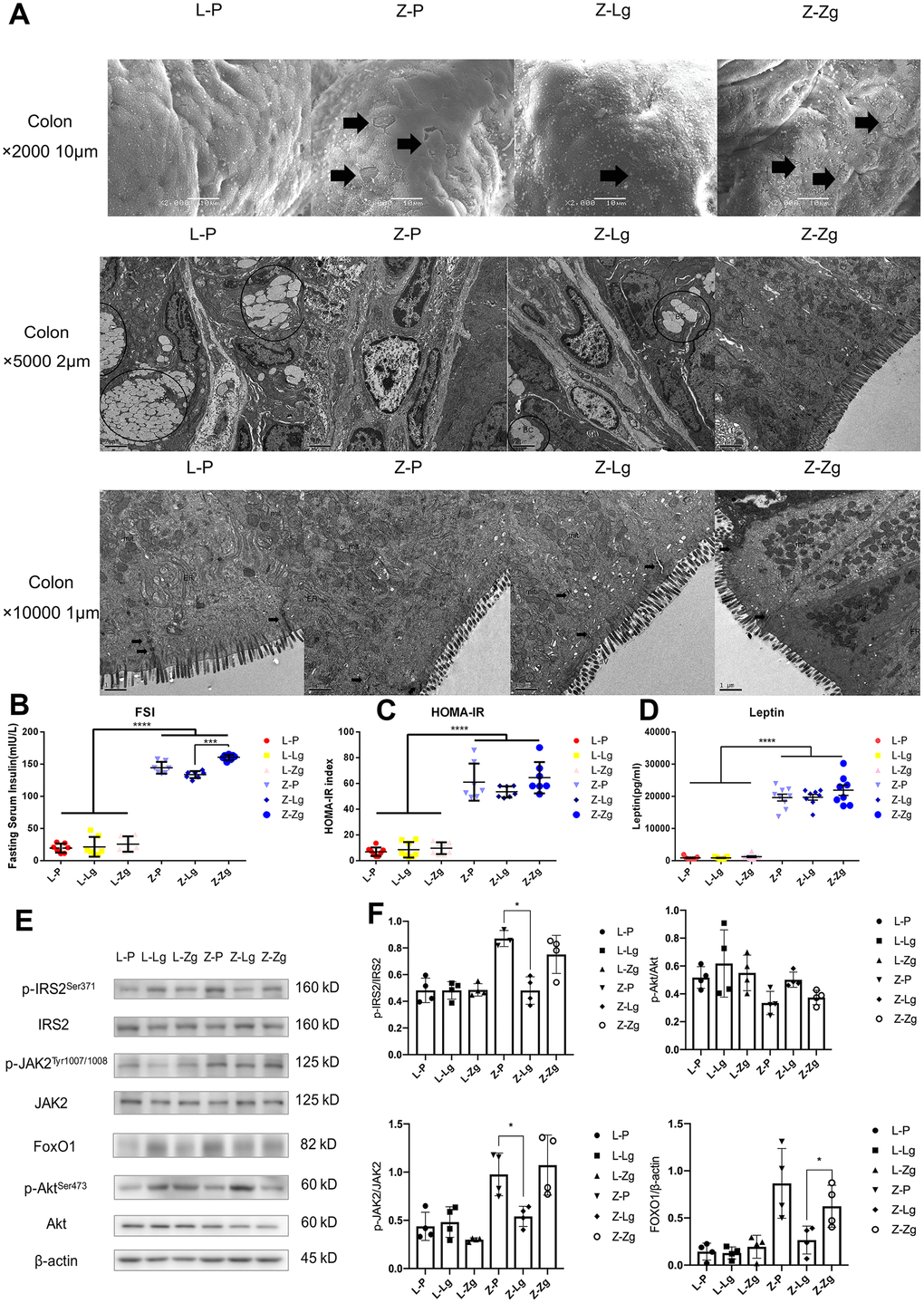 The effects of FMT on the intestinal pathological structure, IR, and LR in rats. (A) The colon surface of rats was magnified 2000 times (upper), 5000 times (middle), and 10,000 times (lower). IV: mucosal layer, microvilli on cell surface. mit: mitochondria. N: nucleus. BC: goblet cells. White vesicle structures were secretory vesicles. ER: endoplasmic reticulum; (B) Fasting serum insulin (mIU / L; F5, 36 = 351.5, P C) HOMA-IR Index (F5, 39 = 85.58, P D) Leptin in 6 groups (pg / mL; F5, 43 = 141.7, P E) Western blotting analysis of IR and LR signaling pathway molecules in liver tissues was performed after FMT; (F) Quantification of western blotting analysis in (D) (p-IRS2 / IRS2: F3, 15 = 2.175, P = 0.0132; p-JAK2 / JAK2: F3, 15 = 0.5387, P = 0.6630; p-Akt / Akt: F3, 15 = 7.221, P = 0.0032; FoxO1 / β-actin: F3, 15 = 6.224, P = 0.0059; n = 3-4). Statistical analysis was performed with two-way ANOVA. *P P 