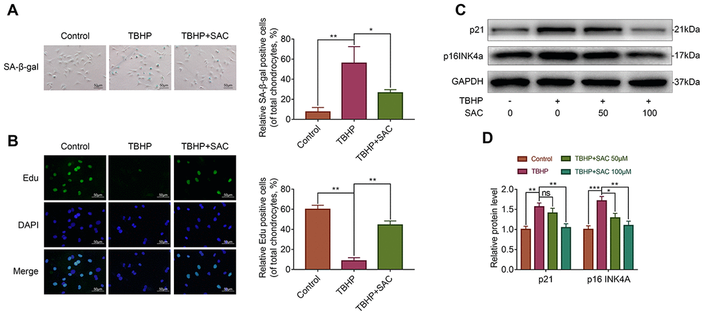 SAC protects TBHP-treated chondrocytes against senescence. (A) Representative images show the SA-β-gal staining assay results in chondrocytes treated with or without SAC for 24 h and 50 μM TBHP for 2 h. Scale bar: 50 μm. (B) Representative images show the EdU staining assay results in chondrocytes treated with or without SAC for 24 h and 50 μM TBHP for 2 h. Scale bar: 50 μm. (C) Representative western blot images and (D) Histogram plots show p21 and p16INK4a protein levels in chondrocytes treated with or without SAC for 24 h and 50 μM TBHP for 2 h. Note: The data are presented as the means ± SD of three independent experiments. *p p p 